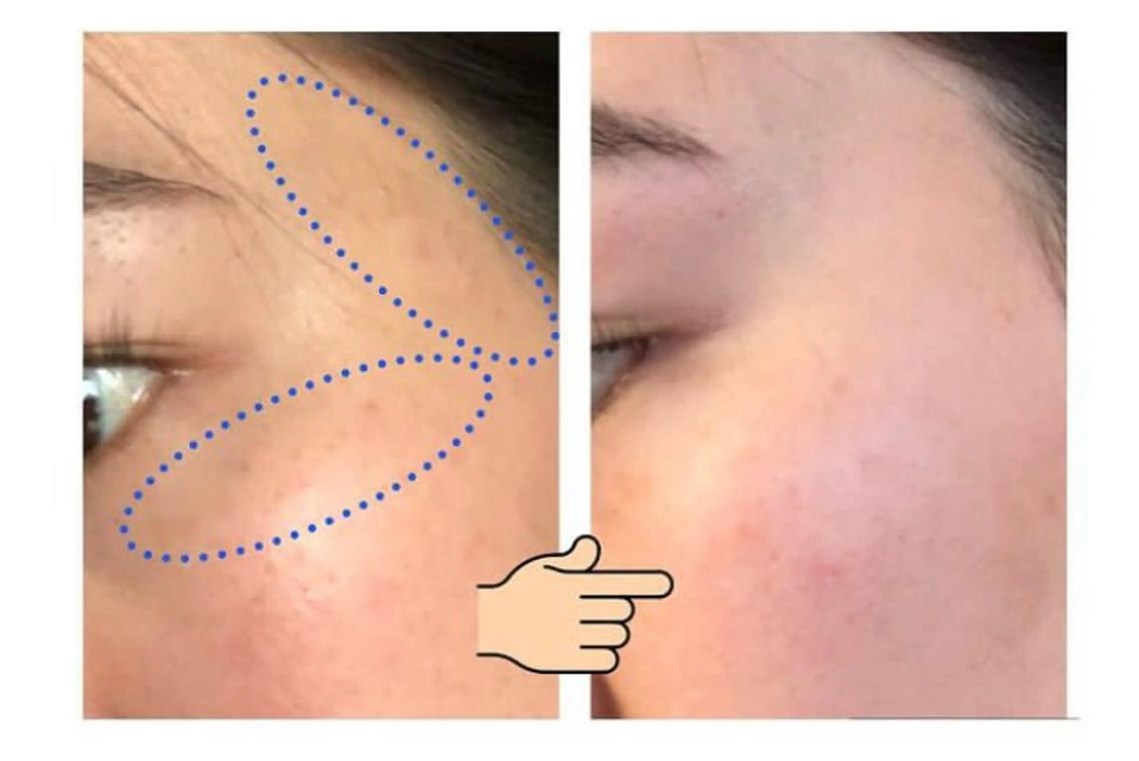 肌質改善サロン La Divinaのエステ・リラクイメージ