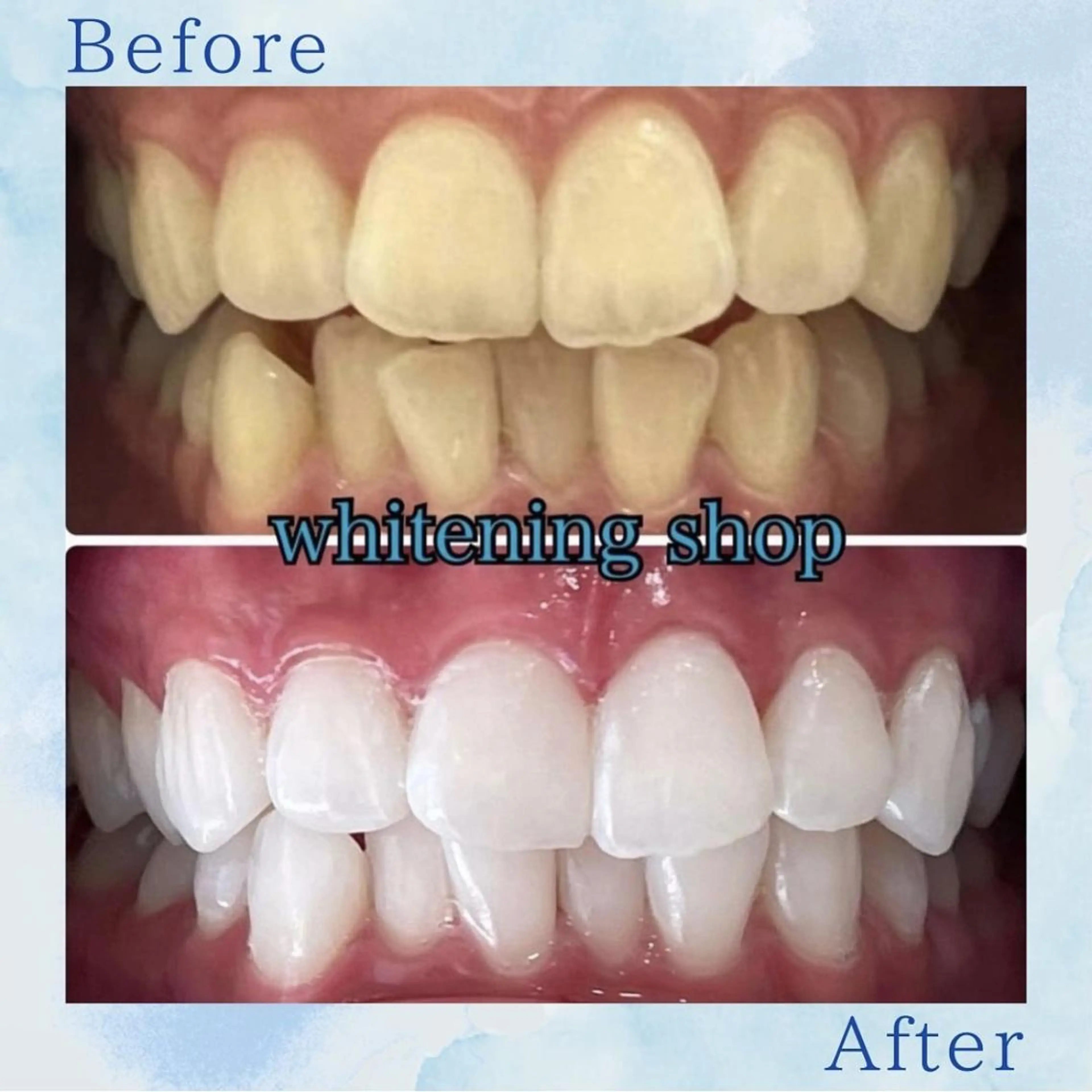 その他 ホワイトニング ショップ葛西店のその他イメージ