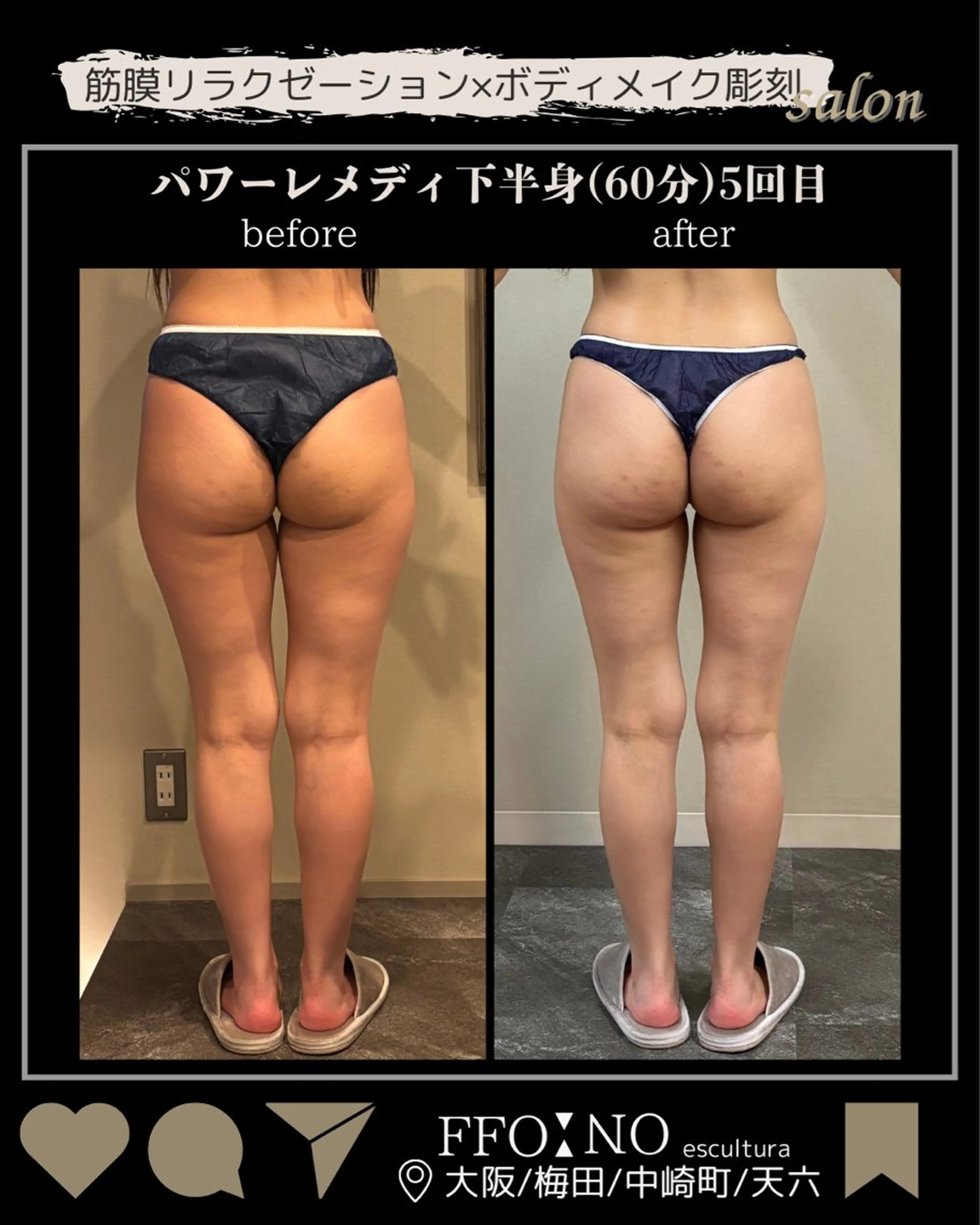 *仮予約* 脚スッキリ革命!下半身むくみ撃退パワーケア50分の写真