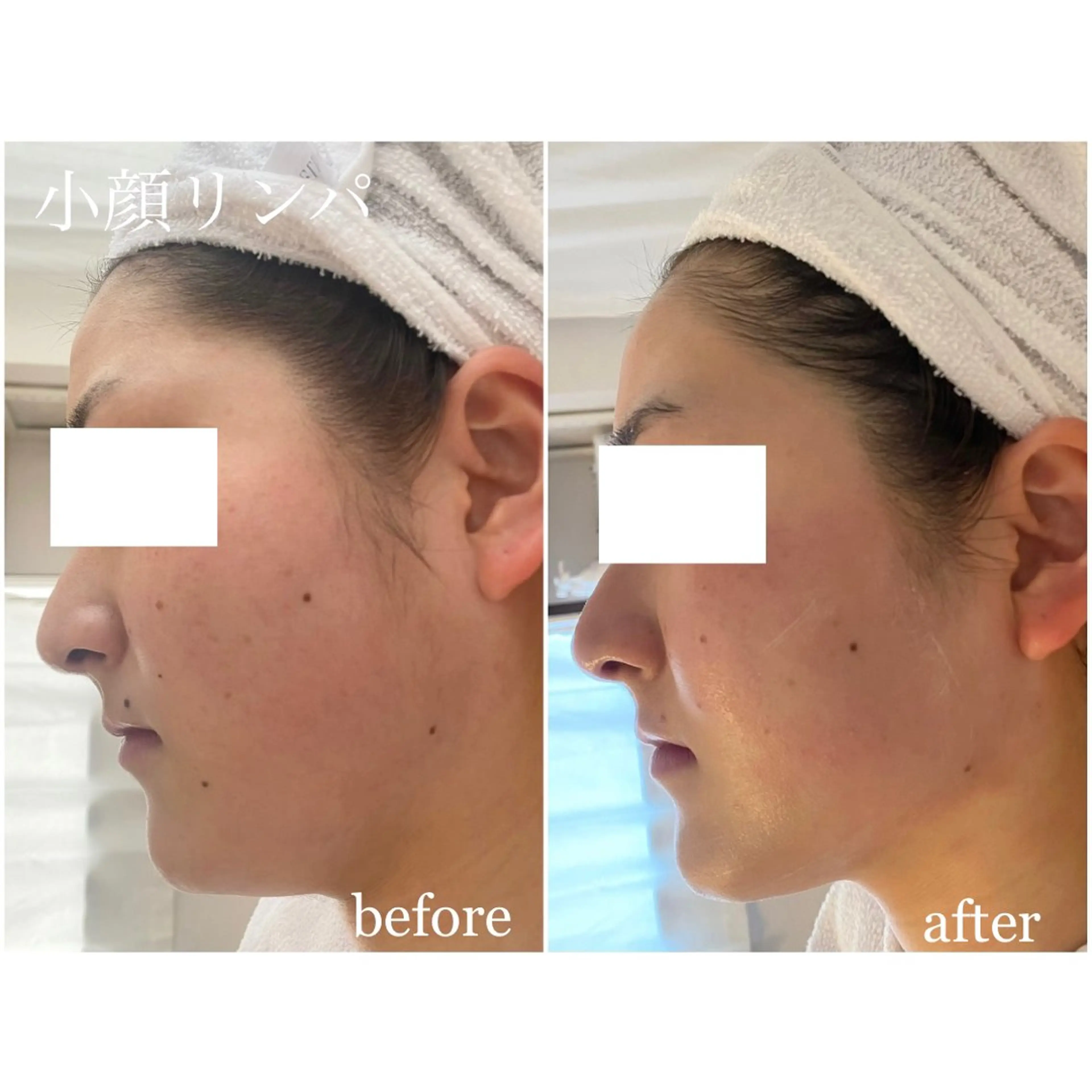 【即効性有り】小顔リンパマッサージ、首/肩/デコルテ付きの写真