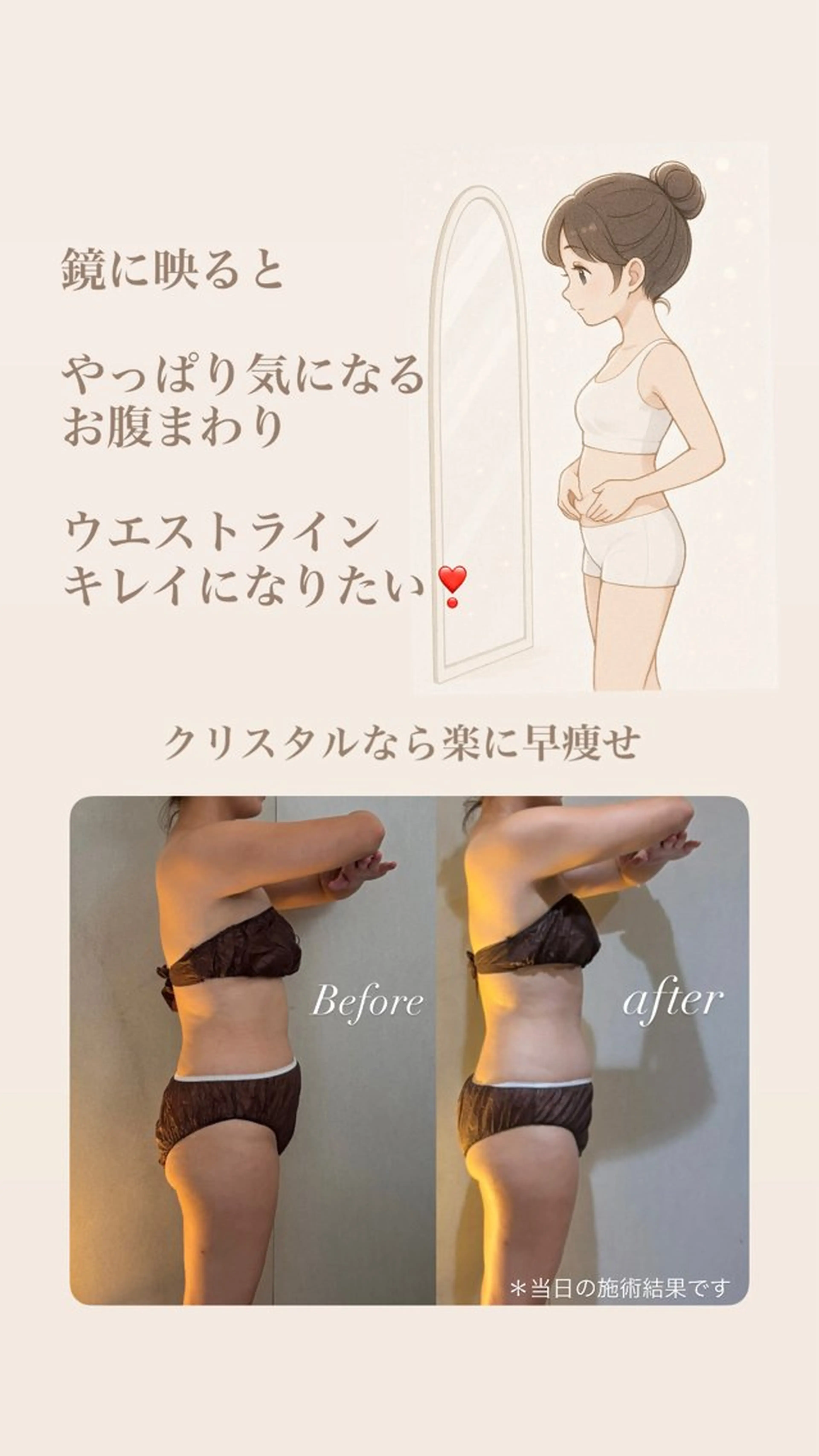 Crystallo Sana N所属・痩身・リンパ 佐久間 自由が丘・奥沢のエステ・リラクイメージ