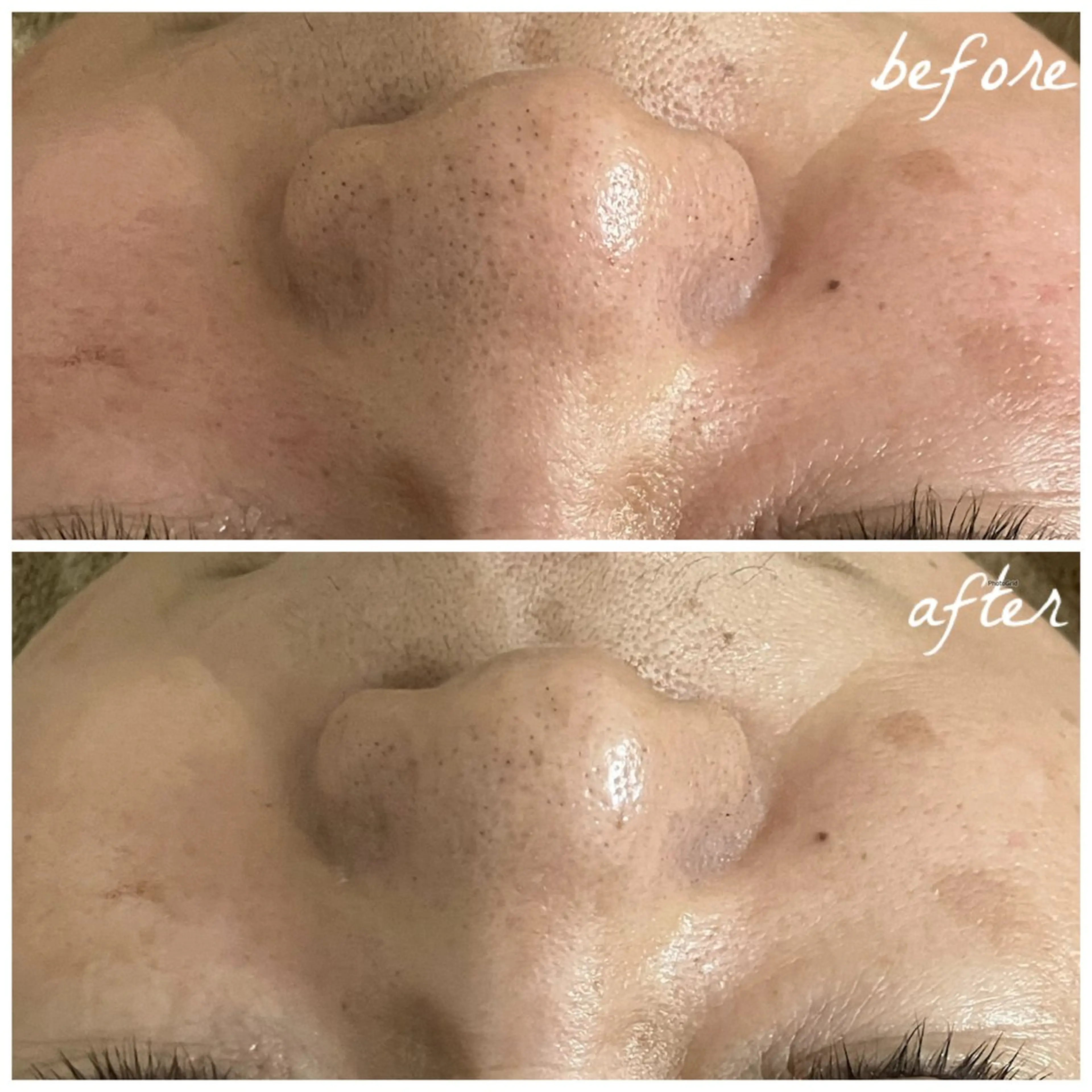 メンズ エステ メナード岐阜茜部 杉浦のエステ・リラクイメージ