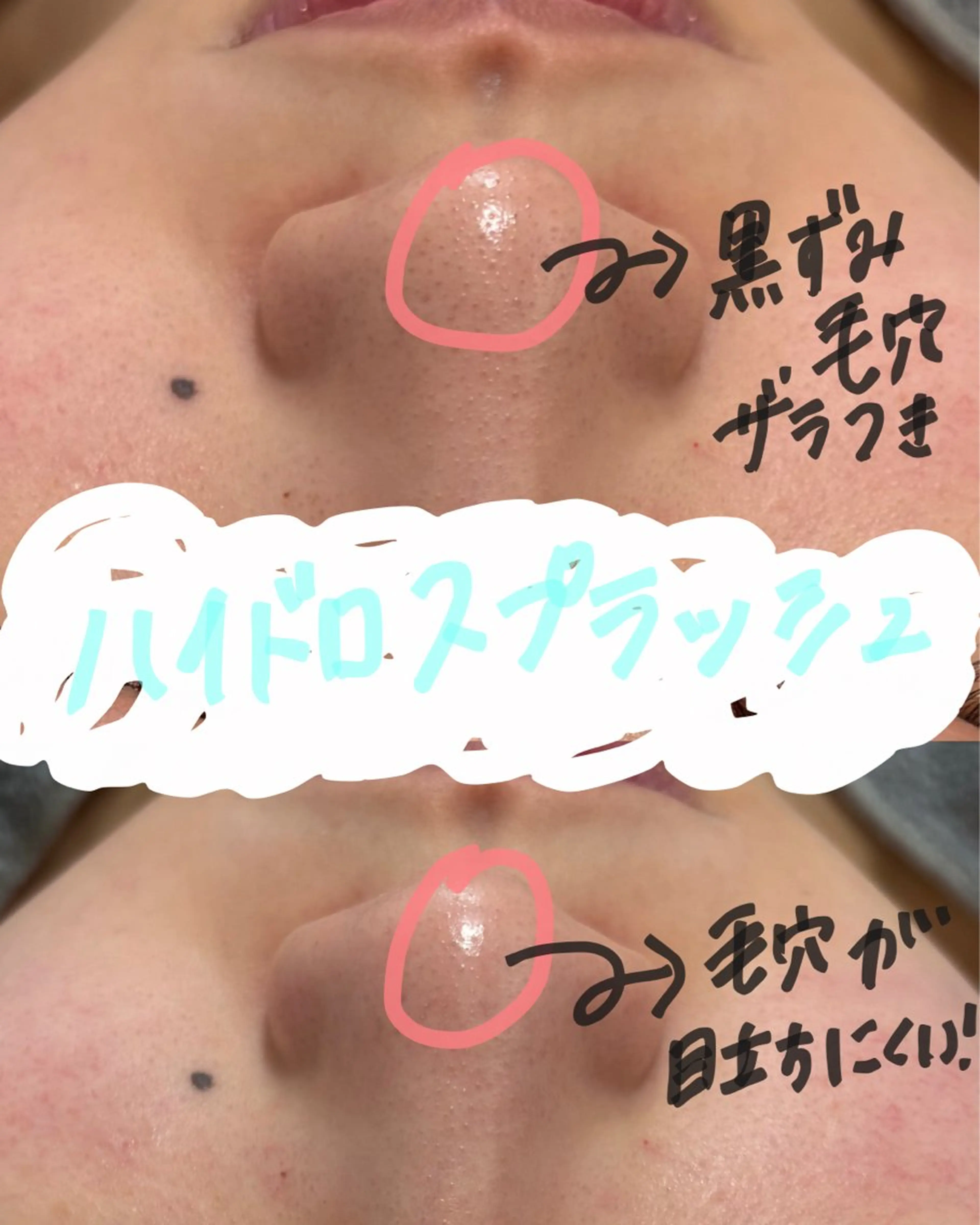 エステ エレファンテブランコ Ayaneのエステ・リラクイメージ