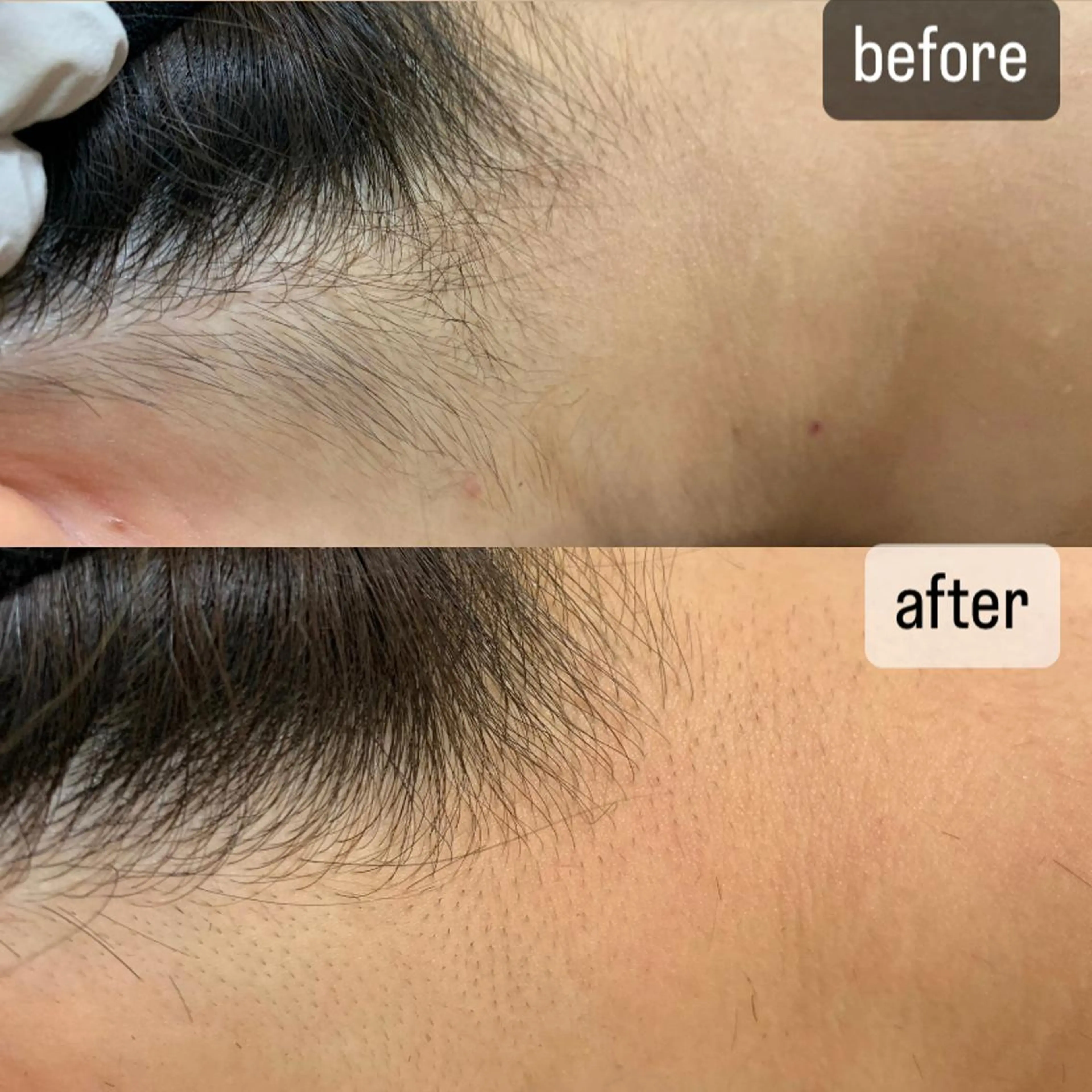 ショート メンズ 脱毛SALON RaYNiCKのエステ・リラクイメージ