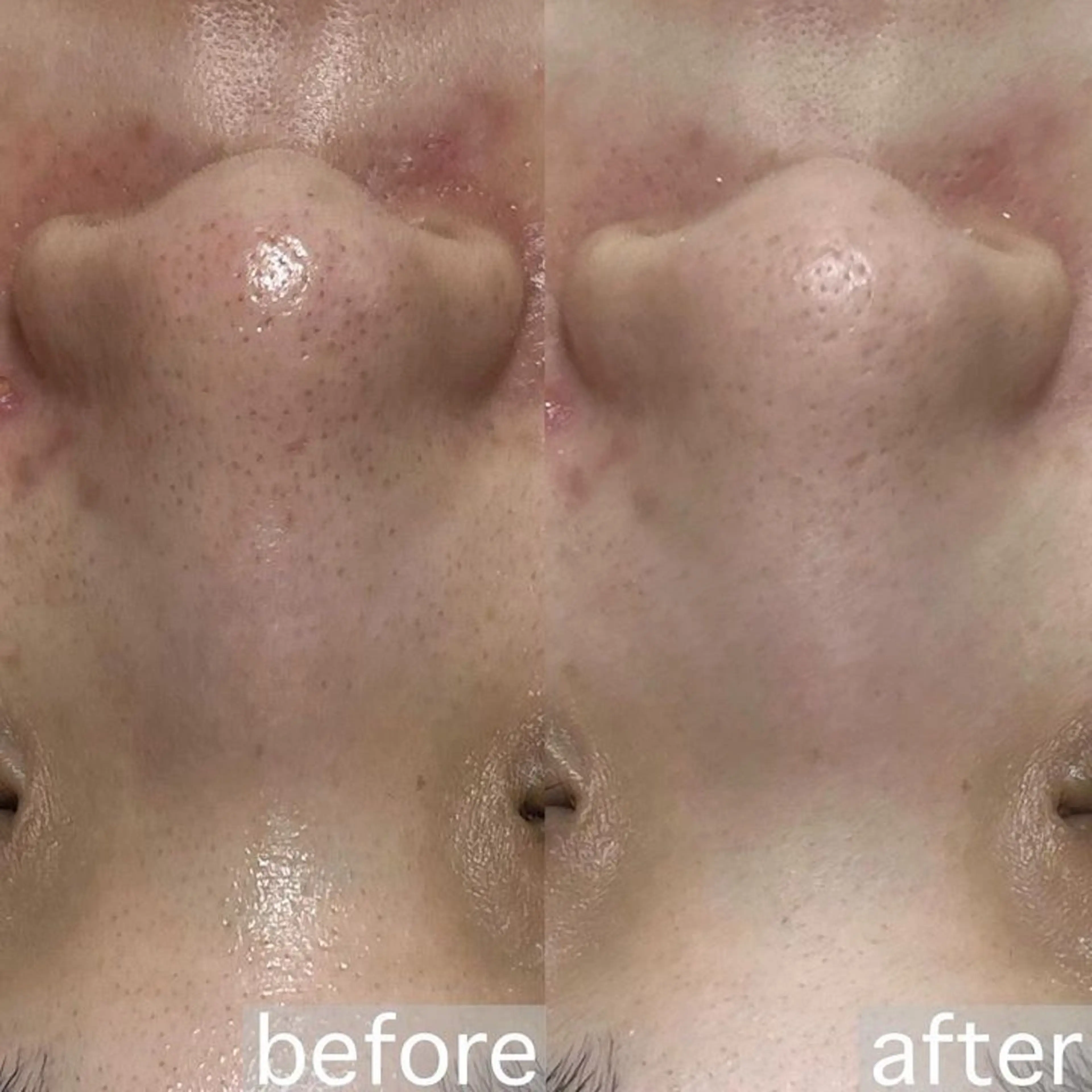 エステ アイブロウ&フェイシャルサロンa‘lm所属・WAX脱毛/肌質改善 眉毛とお肌のサロンのエステ・リラクイメージ