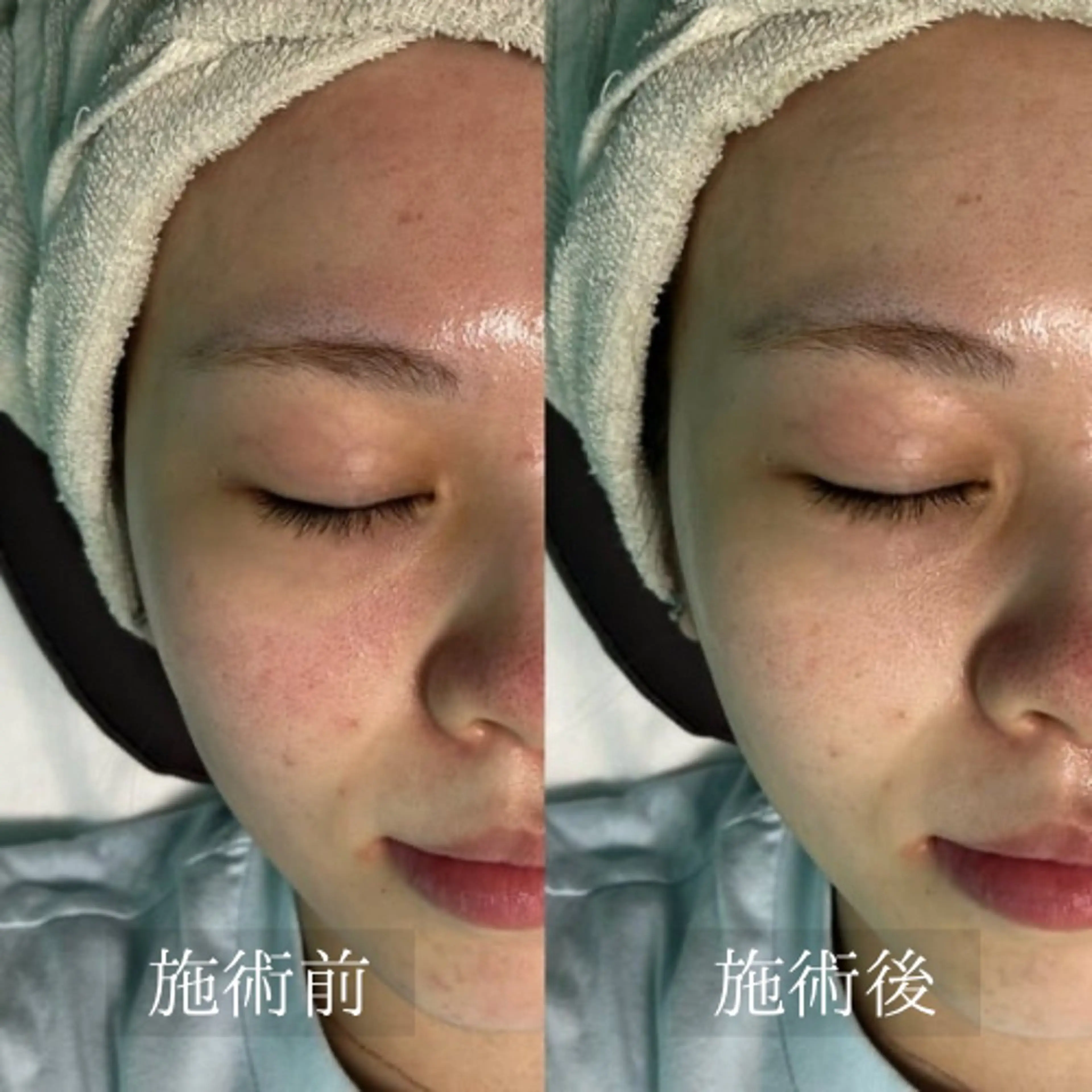 エステ エステサロン　WABISABI所属・【美肌・脱毛専門店】 博多WABISABIのエステ・リラクイメージ