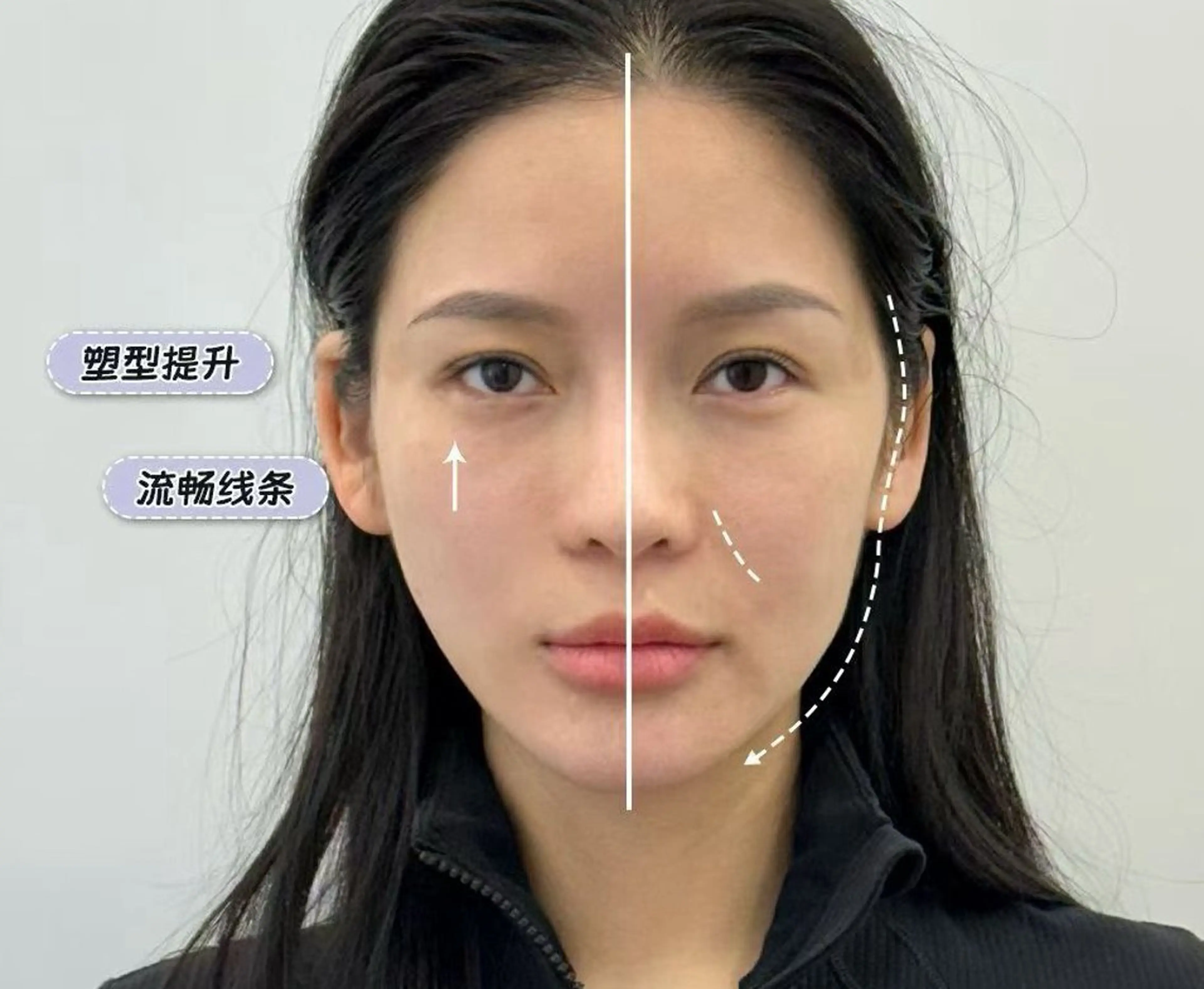 ネイル エステ aliaハイフ&水光ジェットサロン所属・aliaハーブ水光店 エステティシャン募集のエステ・リラクイメージ