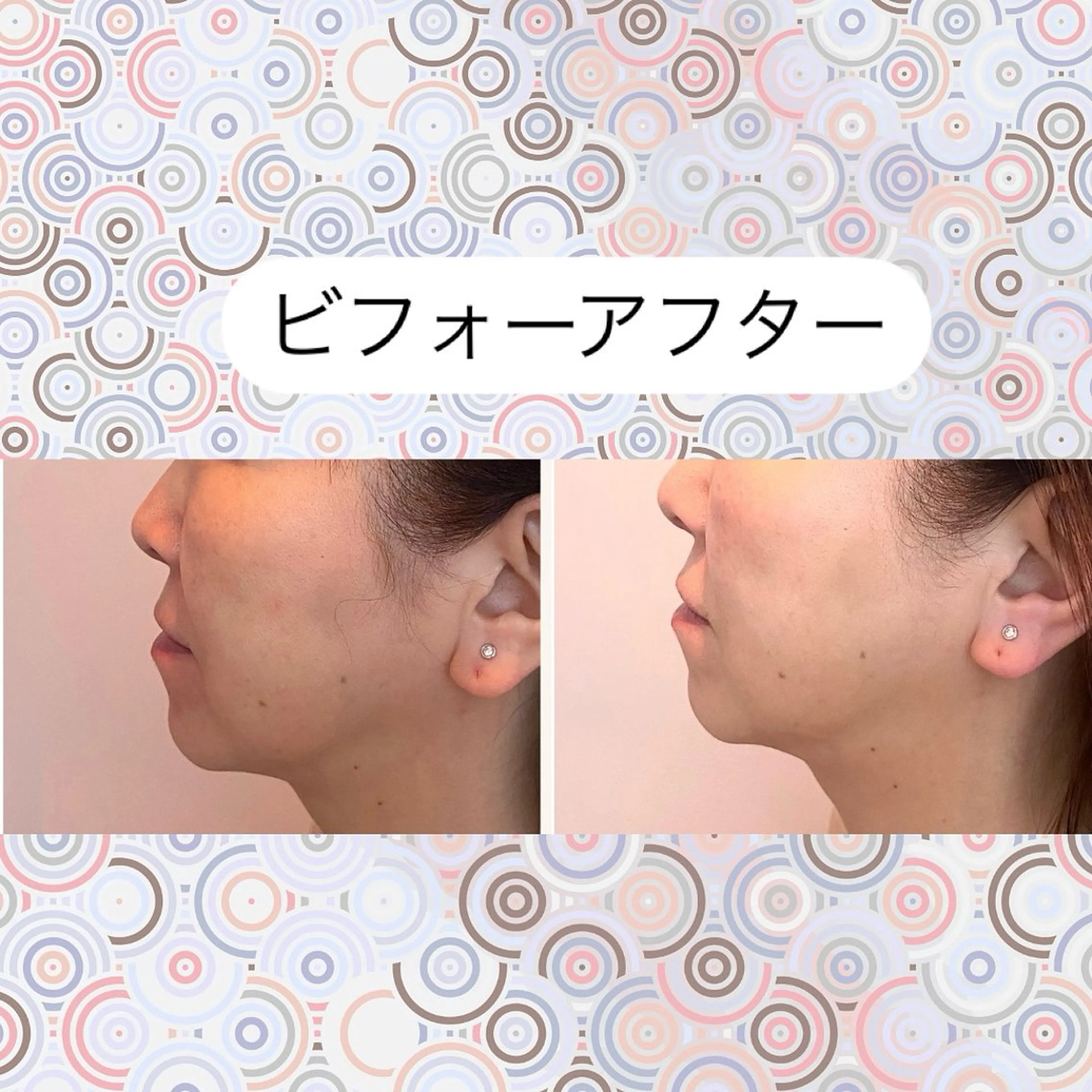 エステ 美容と育毛のサロン Link　松浦のマツエク・マツパデザイン