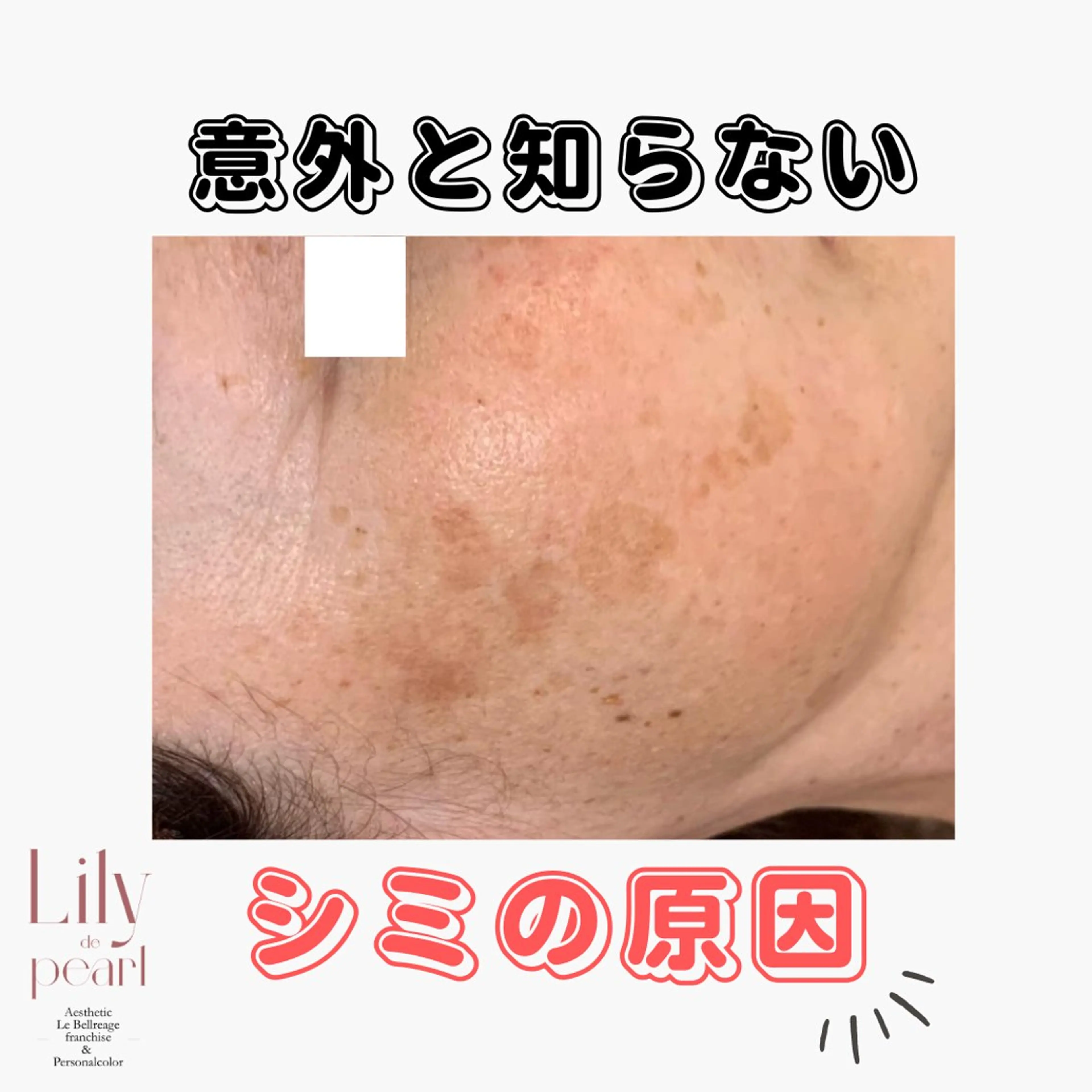 エステ 最新シミケアLily de pearlのエステ・リラクイメージ