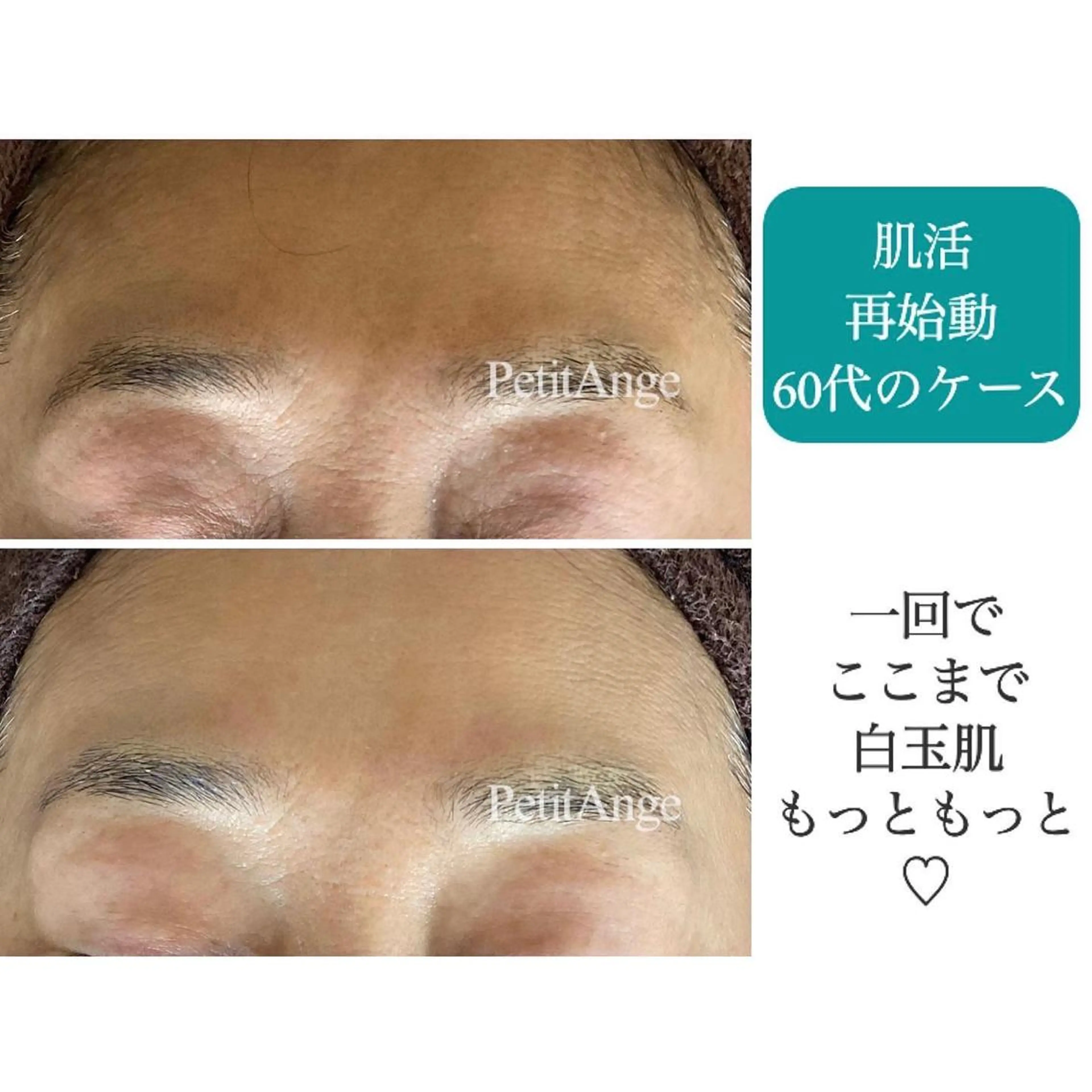 プチアンジェ所属・艶肌&小顔リフト❤︎ プチアンジェ茅ヶ崎のエステ・リラクイメージ