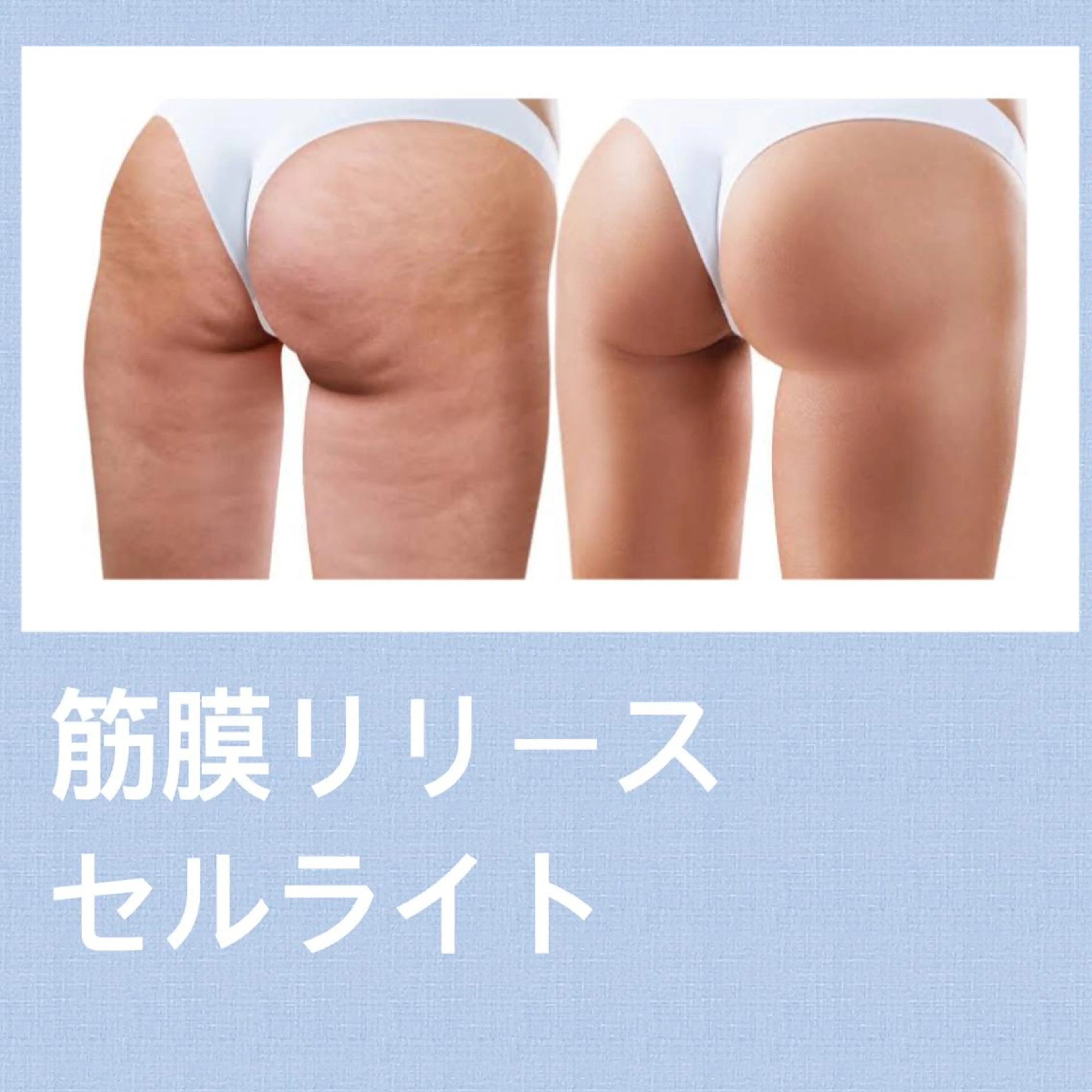 ボディ人気No.1🔥筋膜リリース&セルライトトリートメント 90分🔥の写真