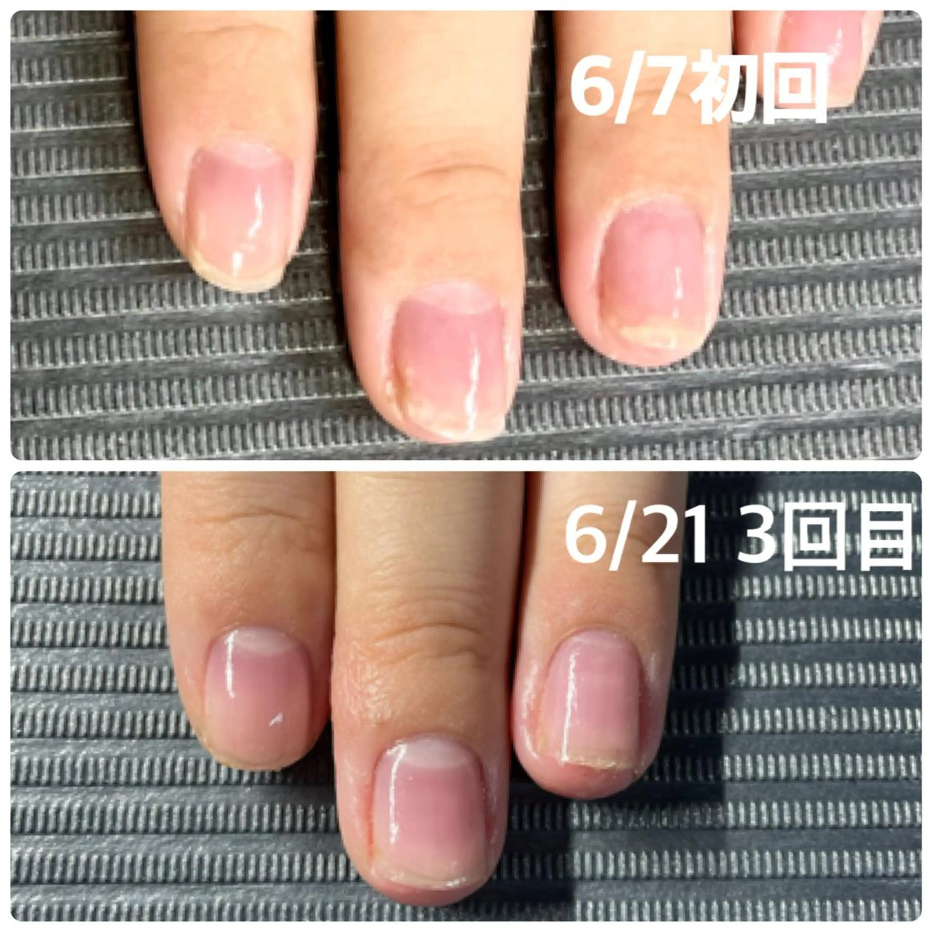 ネイル 奥園 良恵のネイルデザイン