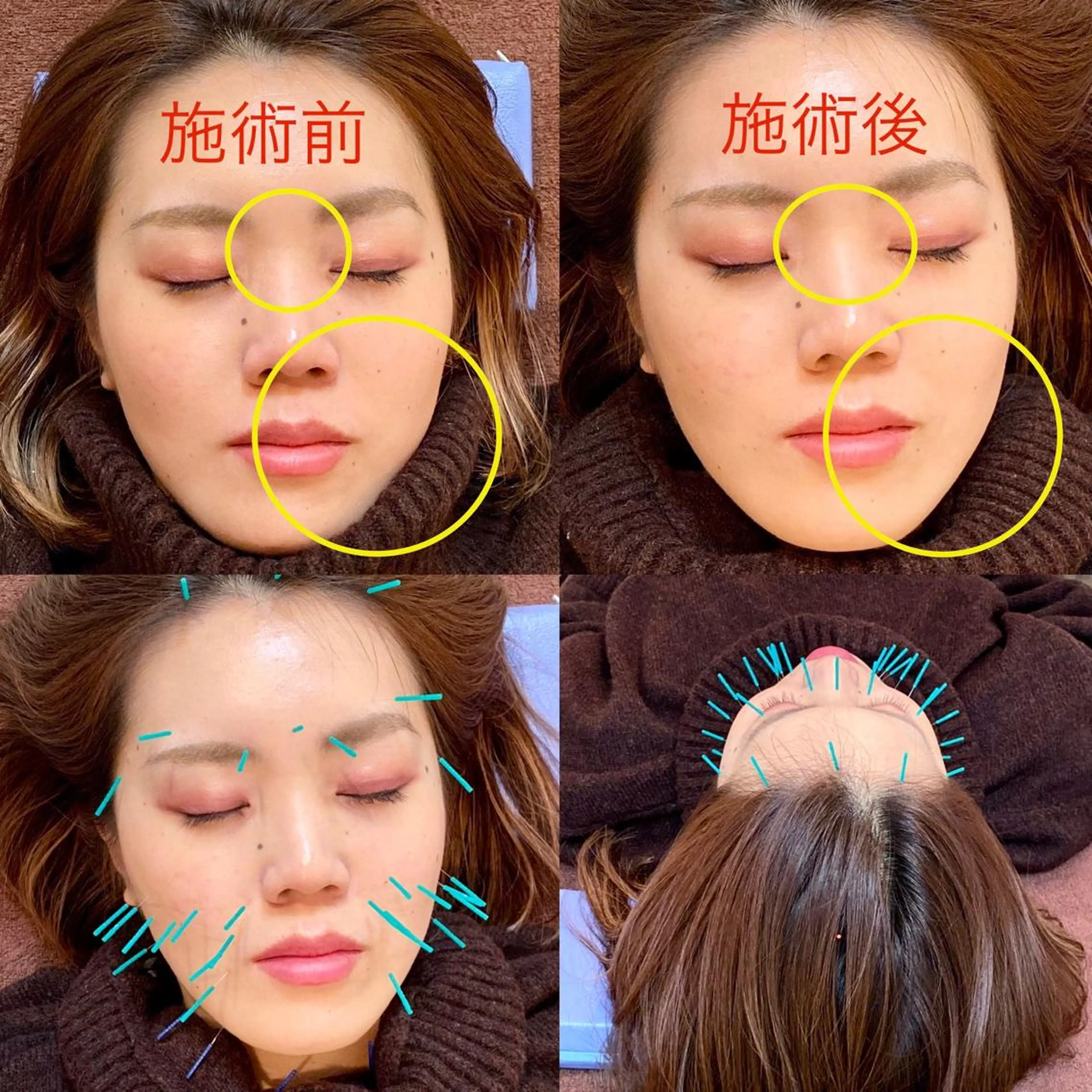 鍼灸整体院　蕾所属・美容鍼 蕾【谷町六丁目】のエステ・リラクイメージ