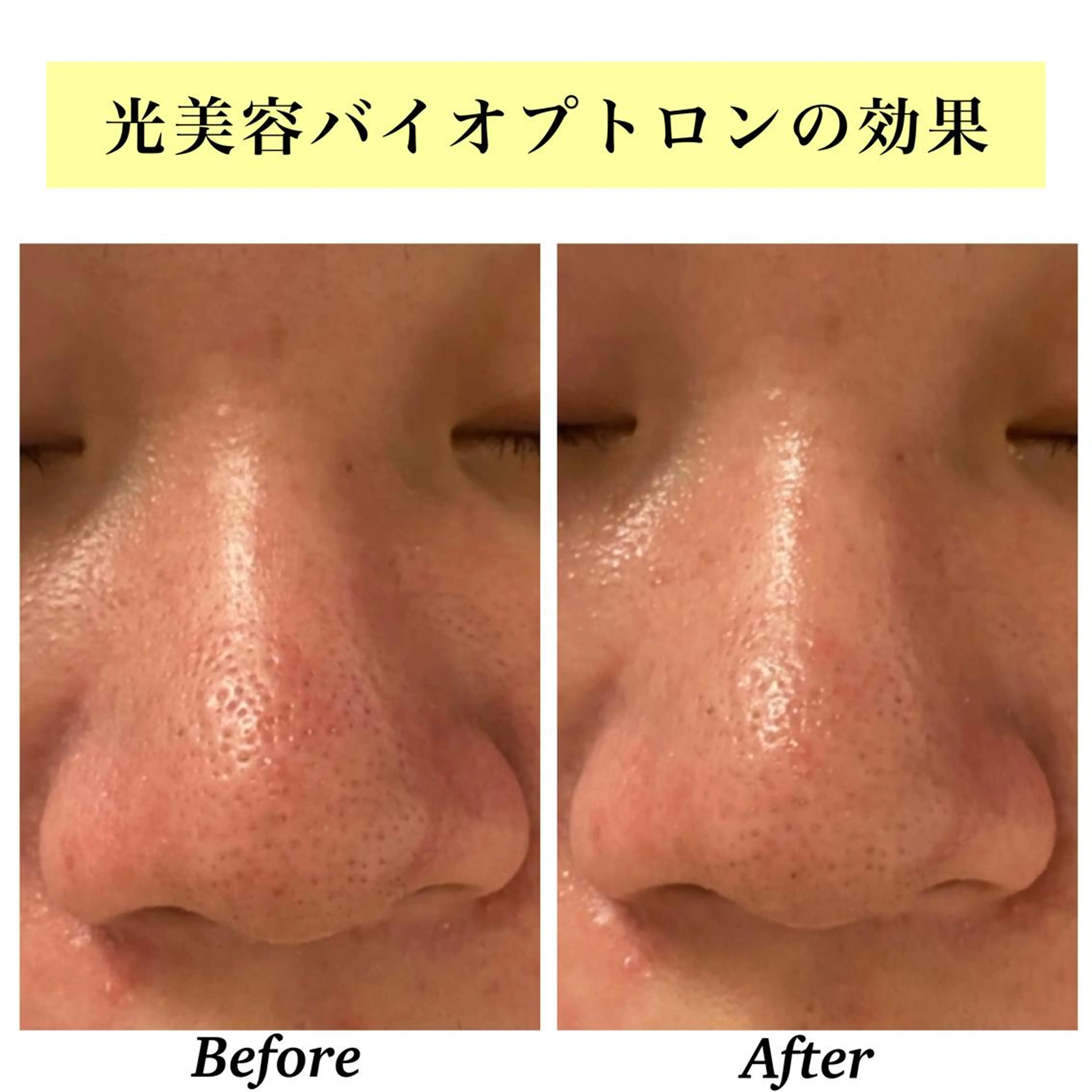 Bellesthe （ベルエステ）のエステ・リラクイメージ