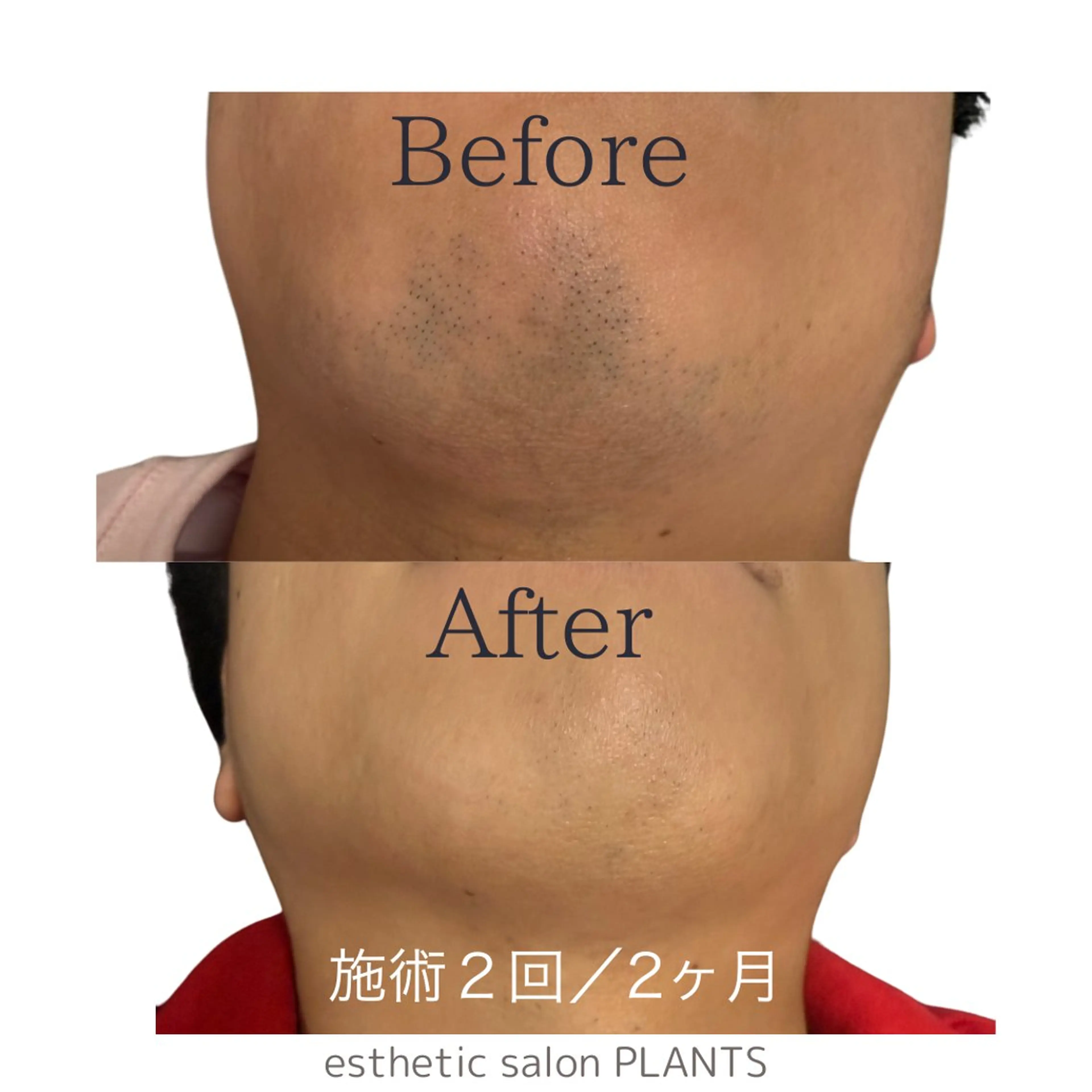 メンズ 脱毛 esthetic salon PLANTS所属・エステティックサロン PLANTSのエステ・リラクイメージ