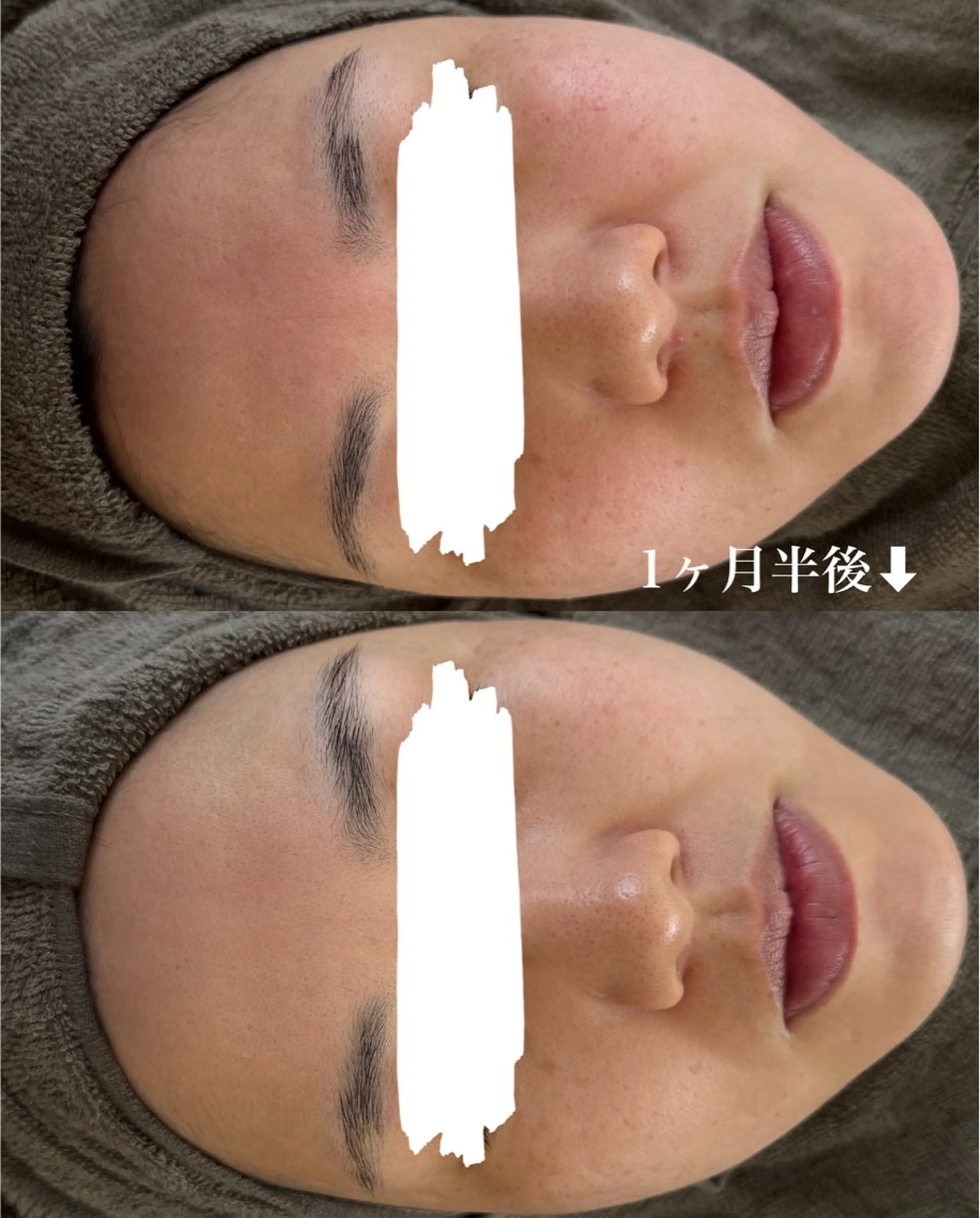 ハーブピーリング専門店lume(ルーム)所属・瀧野 史園のエステ・リラクイメージ