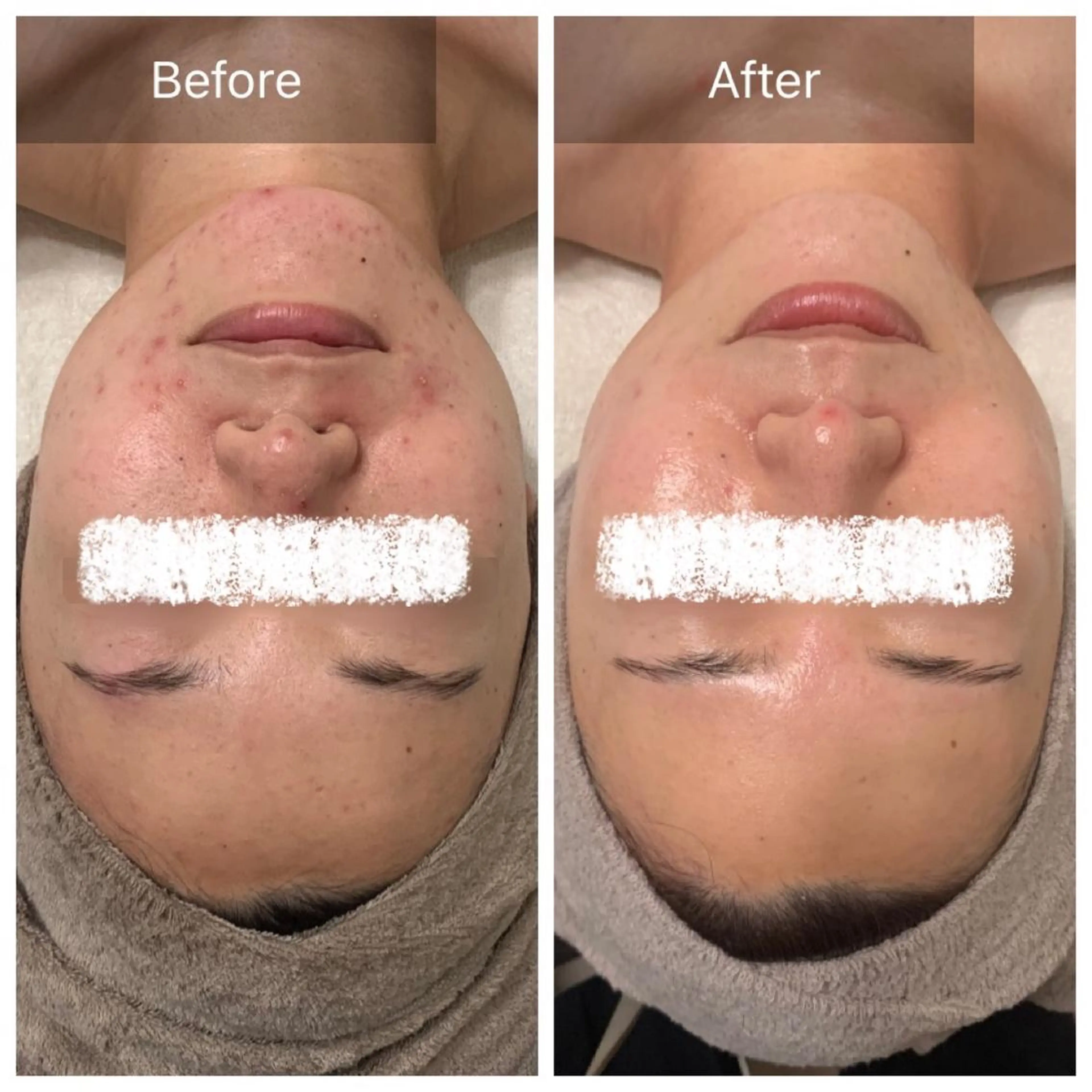 Charis エステ&ネイルのエステ・リラクイメージ