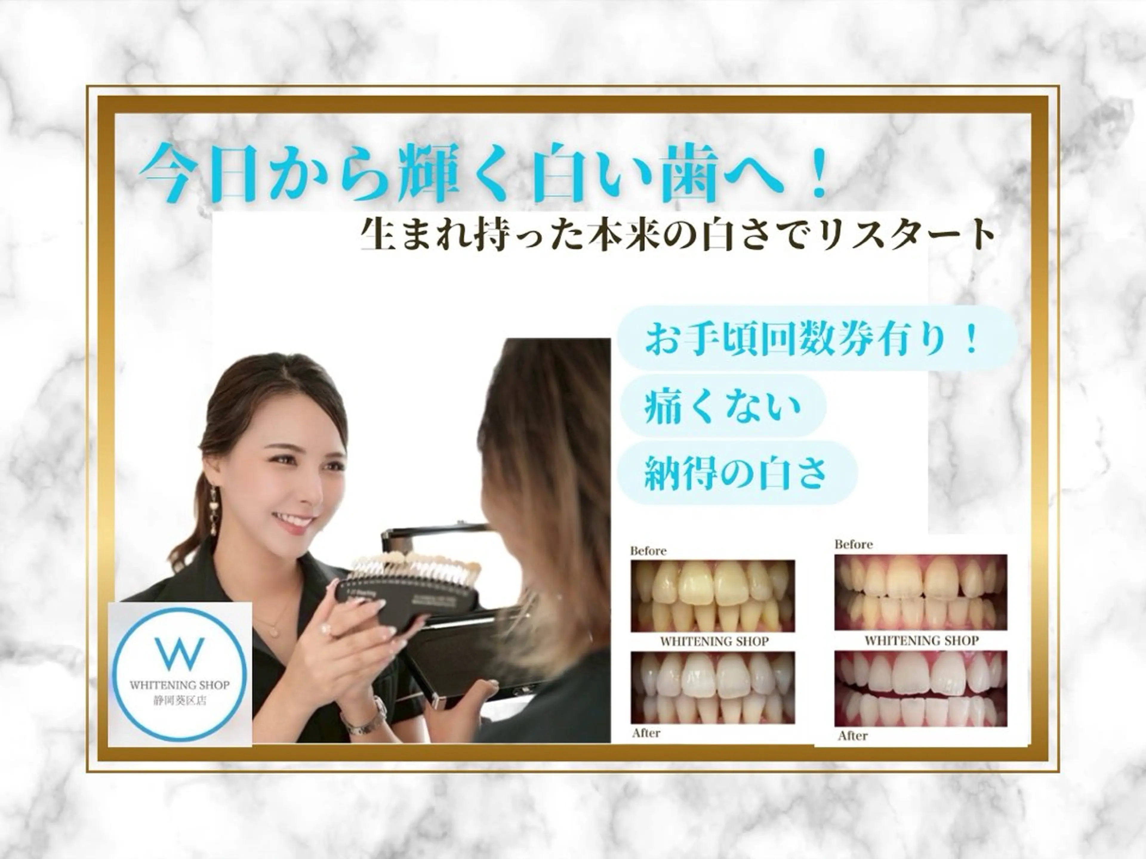 その他 ホワイトニングショップ静岡葵区店所属・ホワイトニング ショップ葵区静岡駅店のその他イメージ