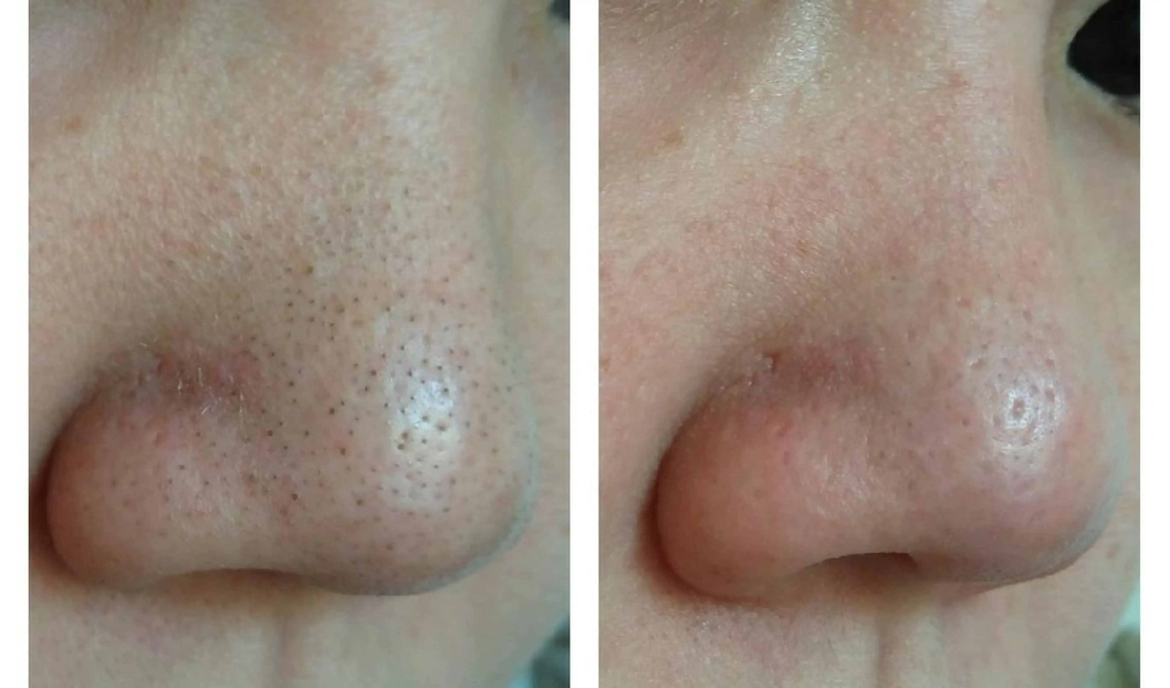 プライベートサロン LaLa 北山まいこのエステ・リラクイメージ