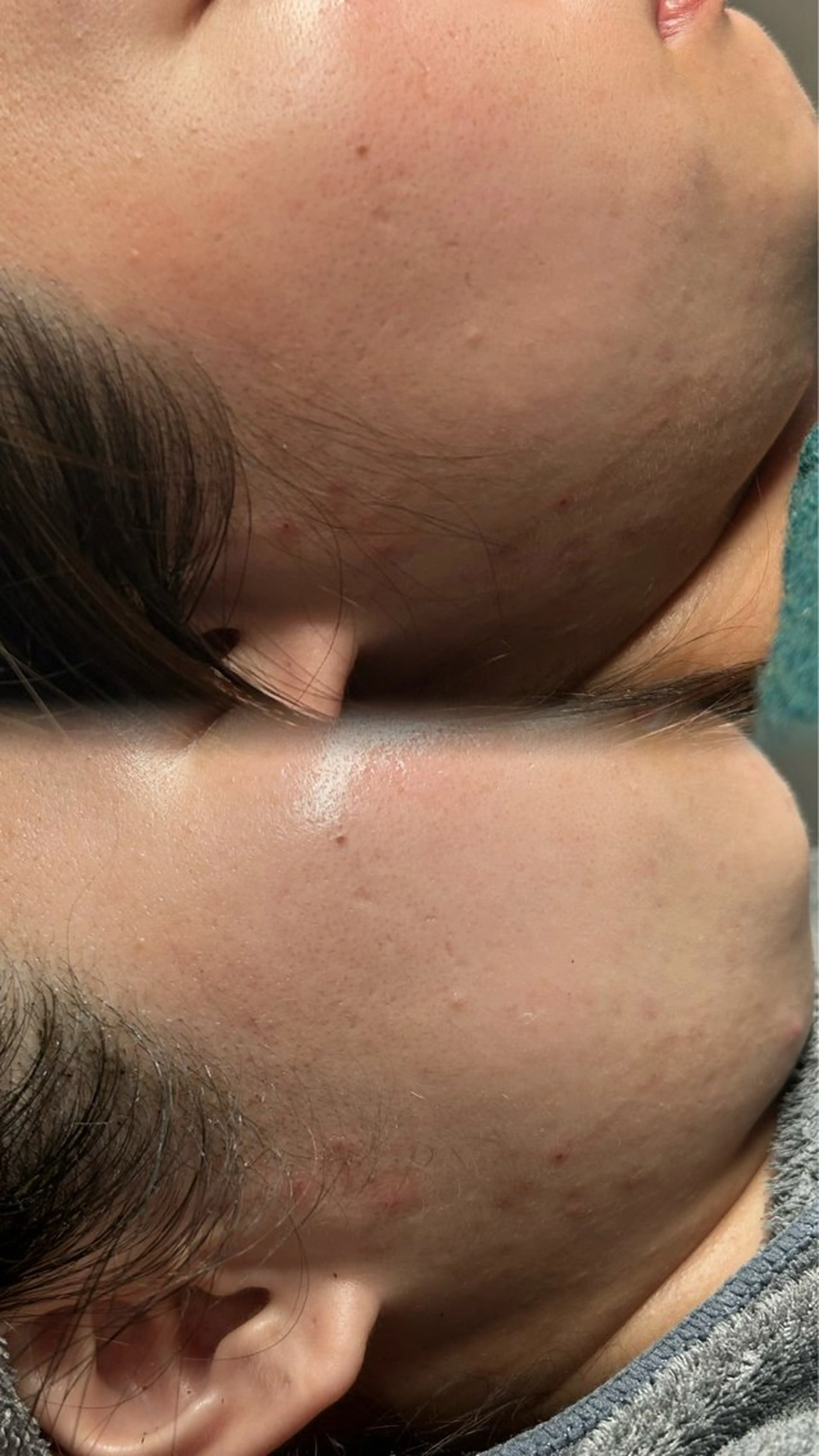 エステ Smoo アユミの眉毛・アイブロウイメージ