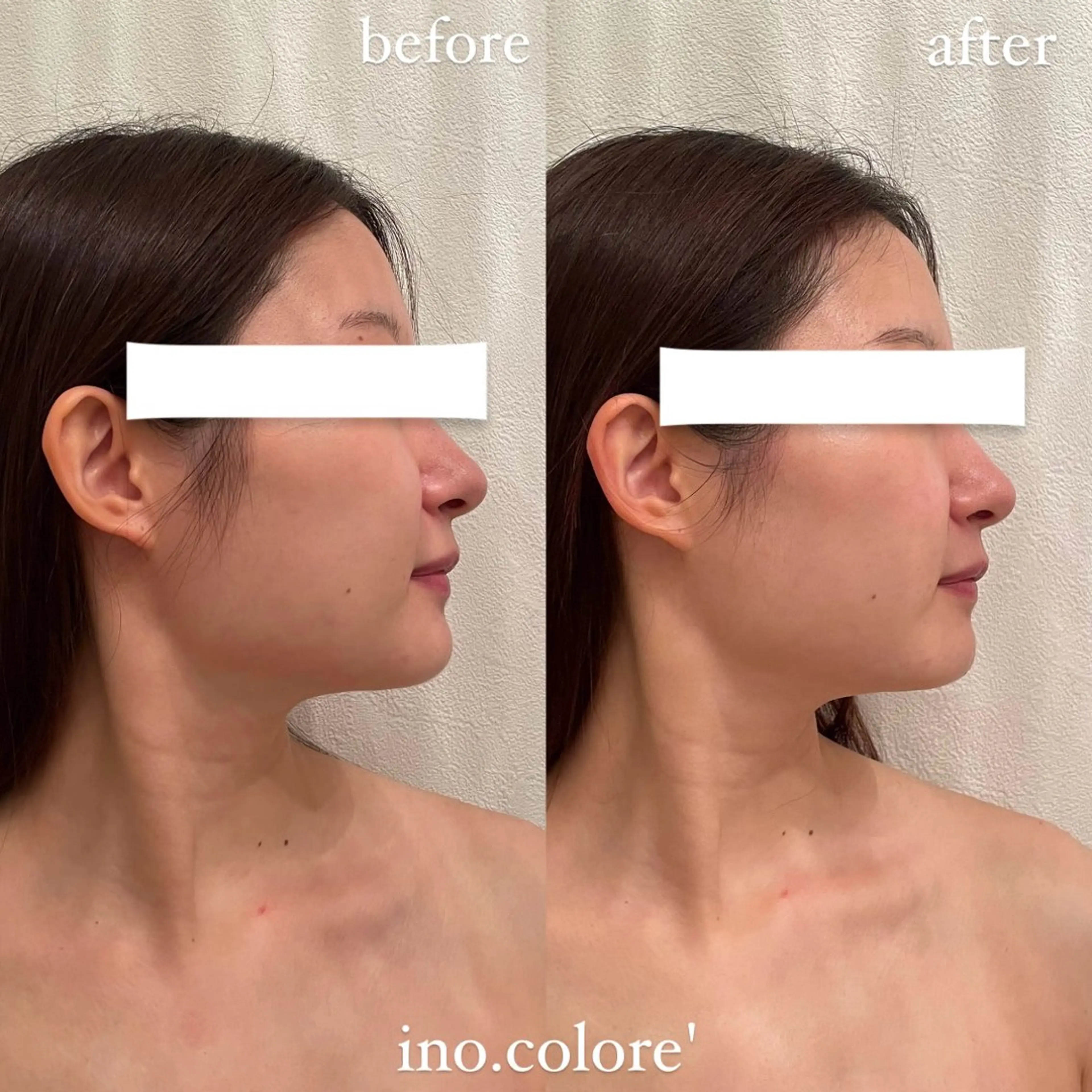 エステ リラク エステサロンino.colore'所属・小顔サロン ino.coloreのエステ・リラクイメージ