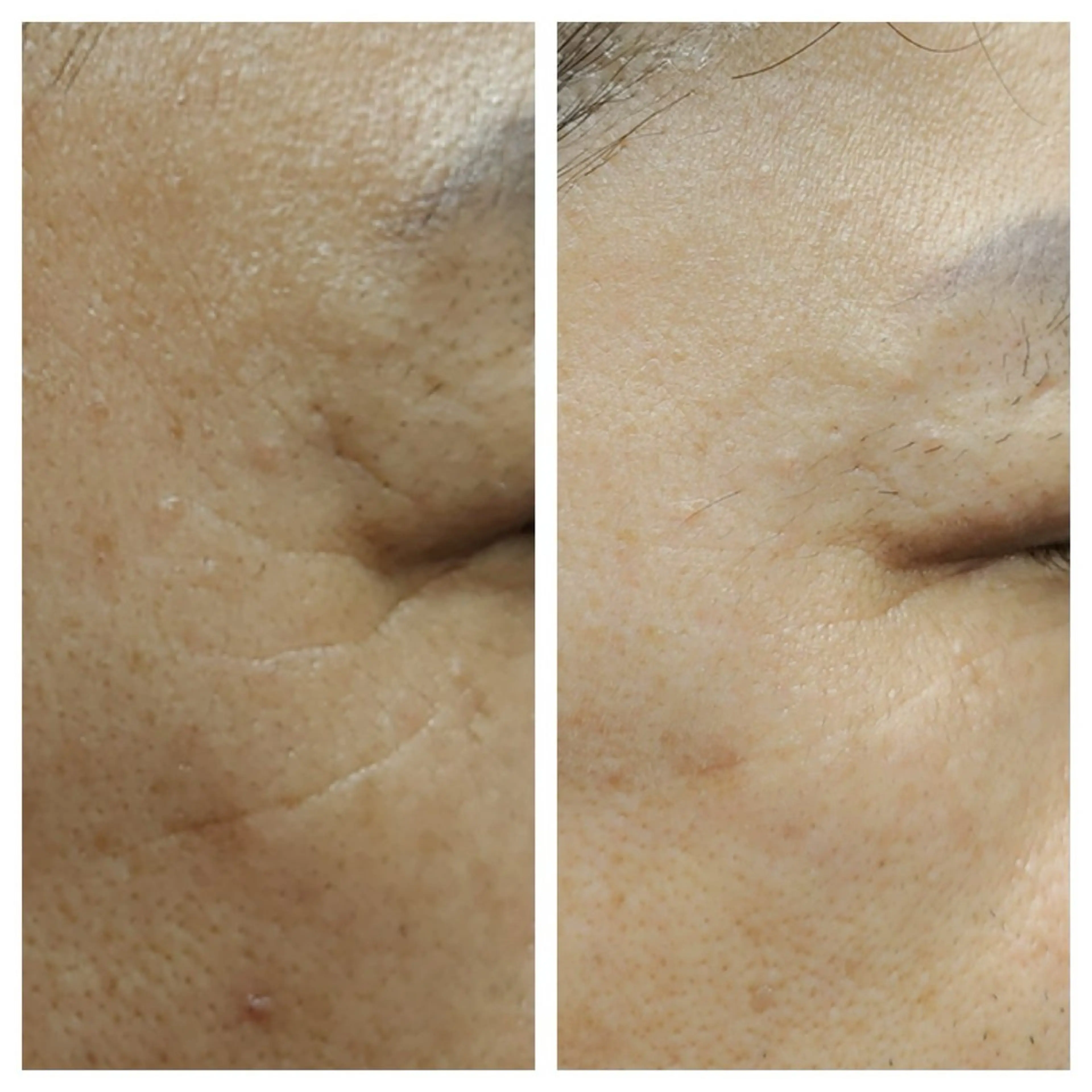 表参道鍼灸院K 美容鍼🔮ララピールのエステ・リラクイメージ