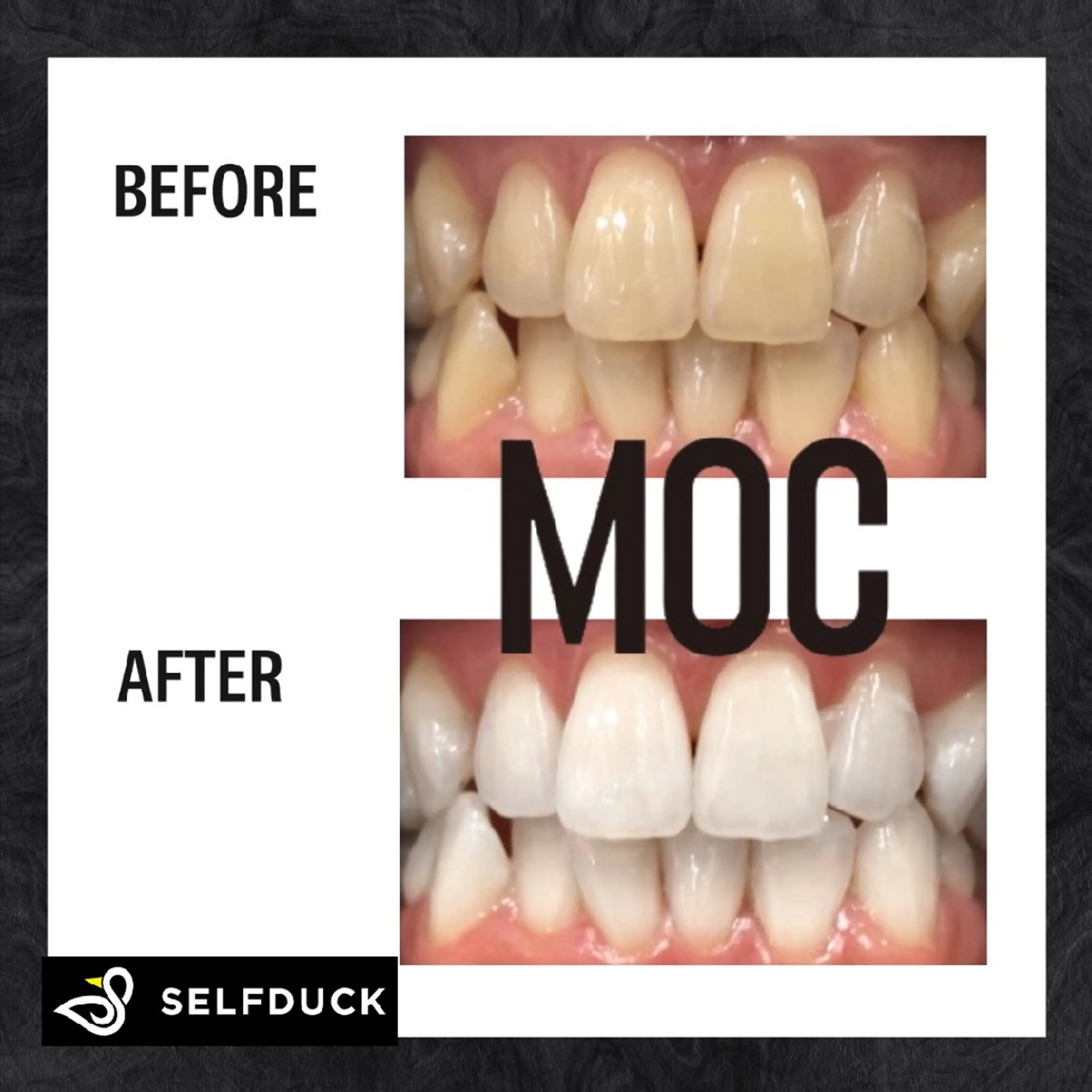 歯科提携セルフダック 宇都宮駒生店のエステ・リラクイメージ