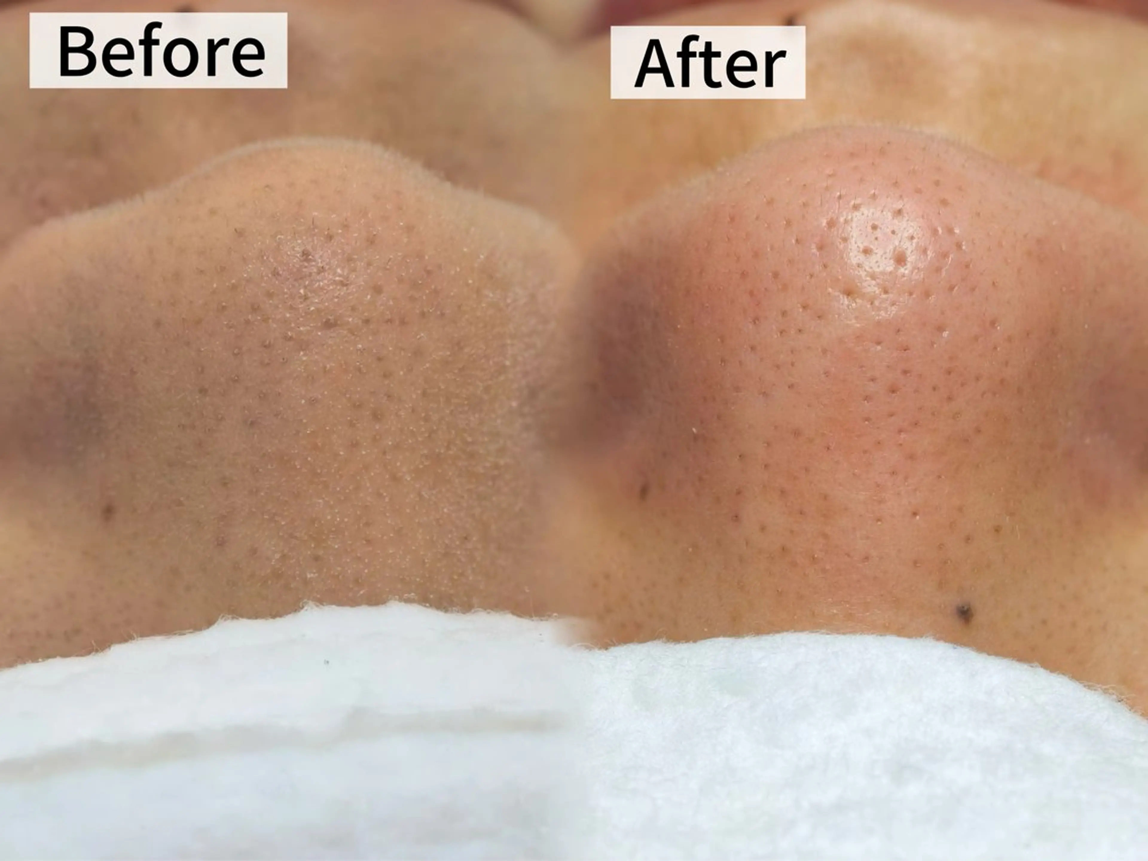 LUMINAESTH所属・LUMINA ESTHのエステ・リラクイメージ