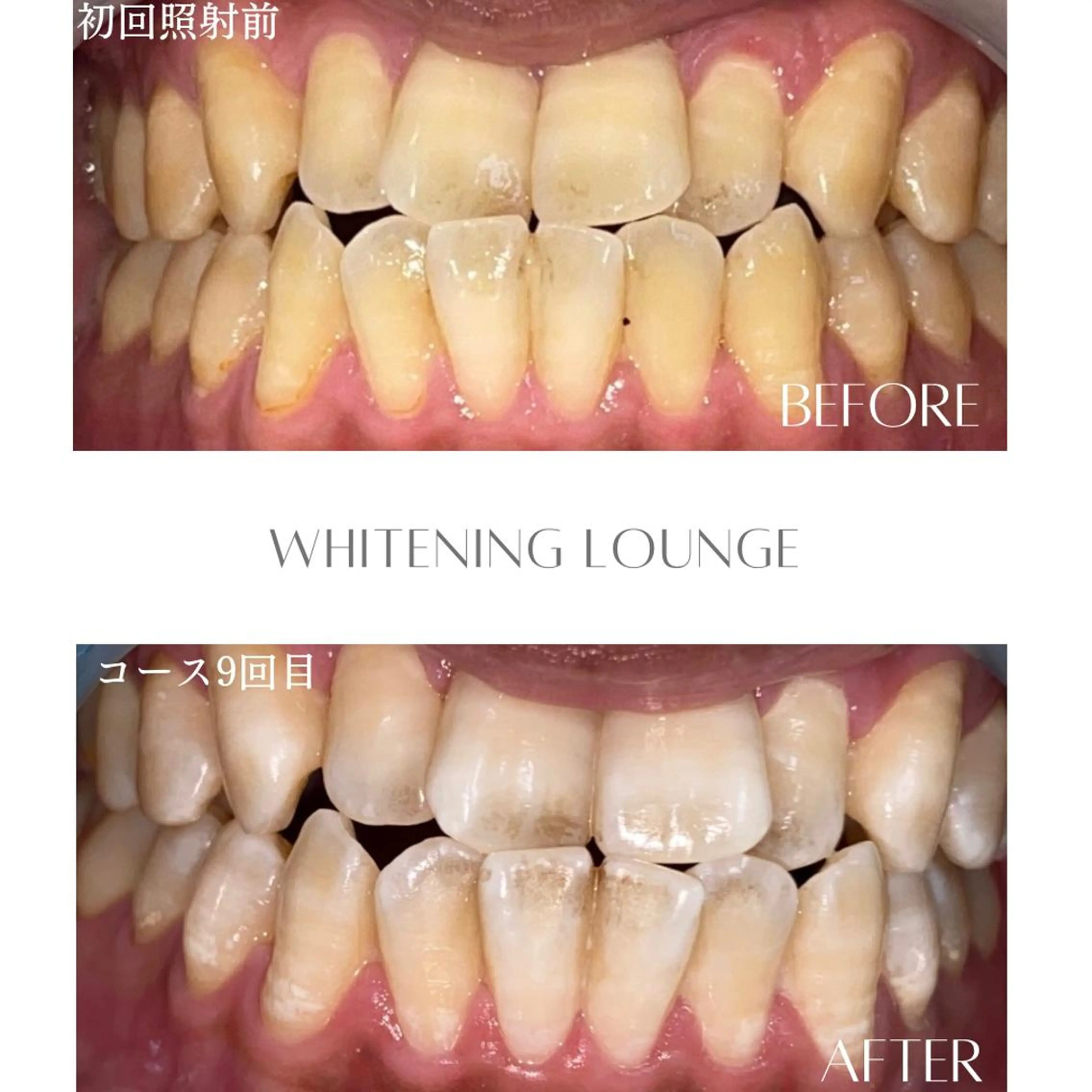 その他 ホワイトニングラウンジ横須賀所属・ホワイトニング Lounge横須賀のその他イメージ