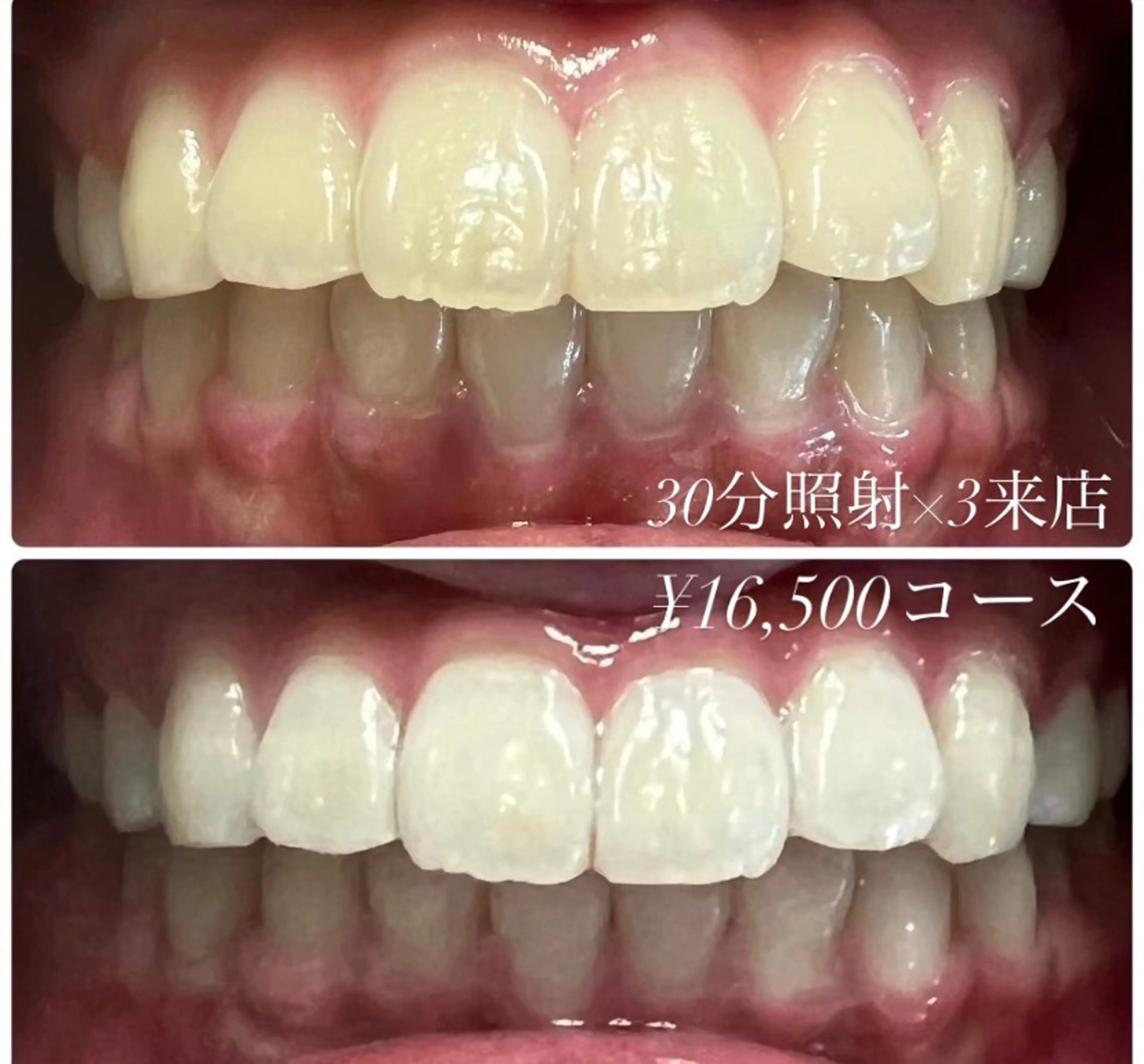 メンズ キッズ その他 ホワイトニングルーム　川崎店所属・ホワイトニング ルーム　川崎店のその他イメージ