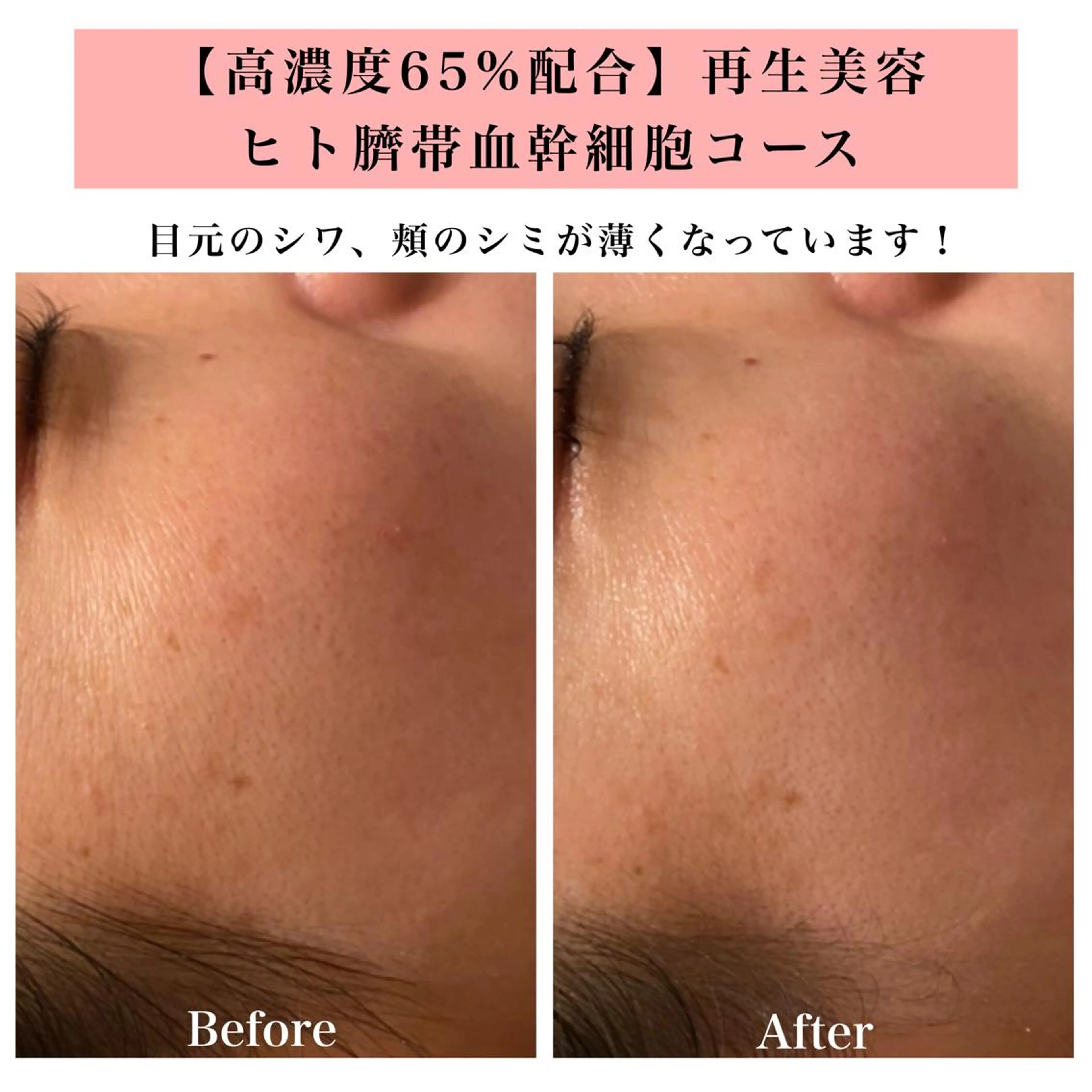 エステ リラク Bellesthe （ベルエステ）のエステ・リラクイメージ