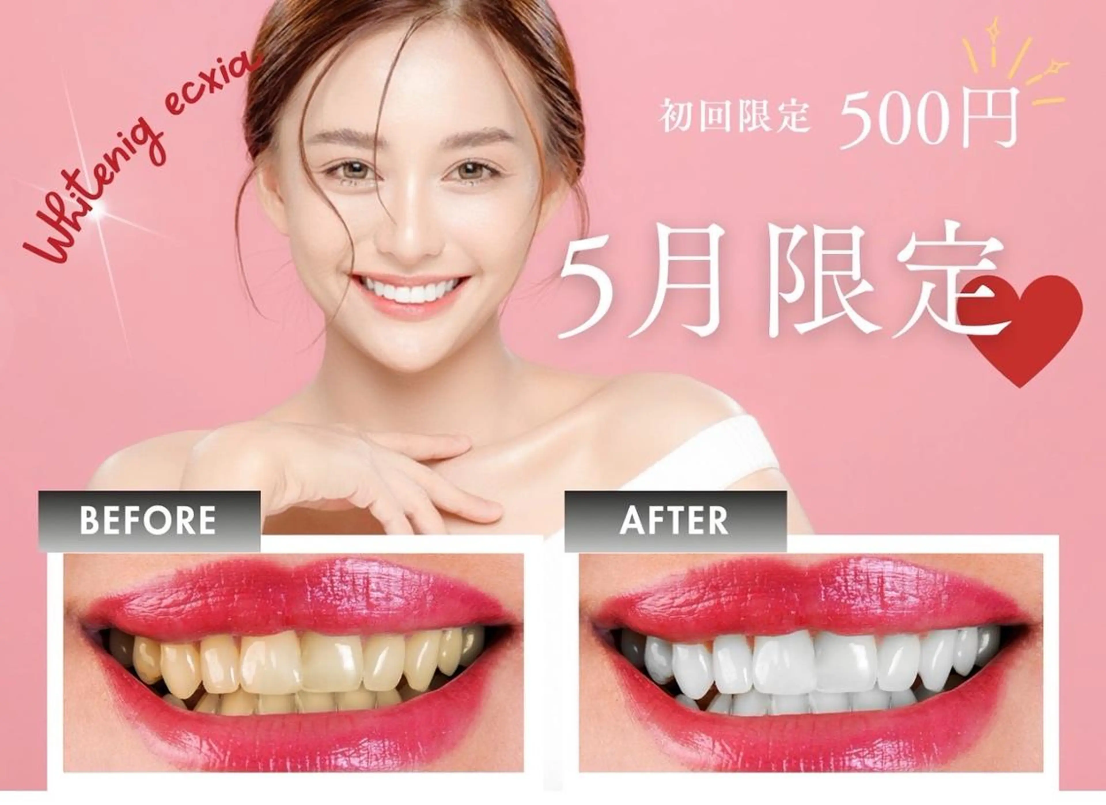 その他 セルフホワイトニング エクシア沖縄宮里店のその他イメージ