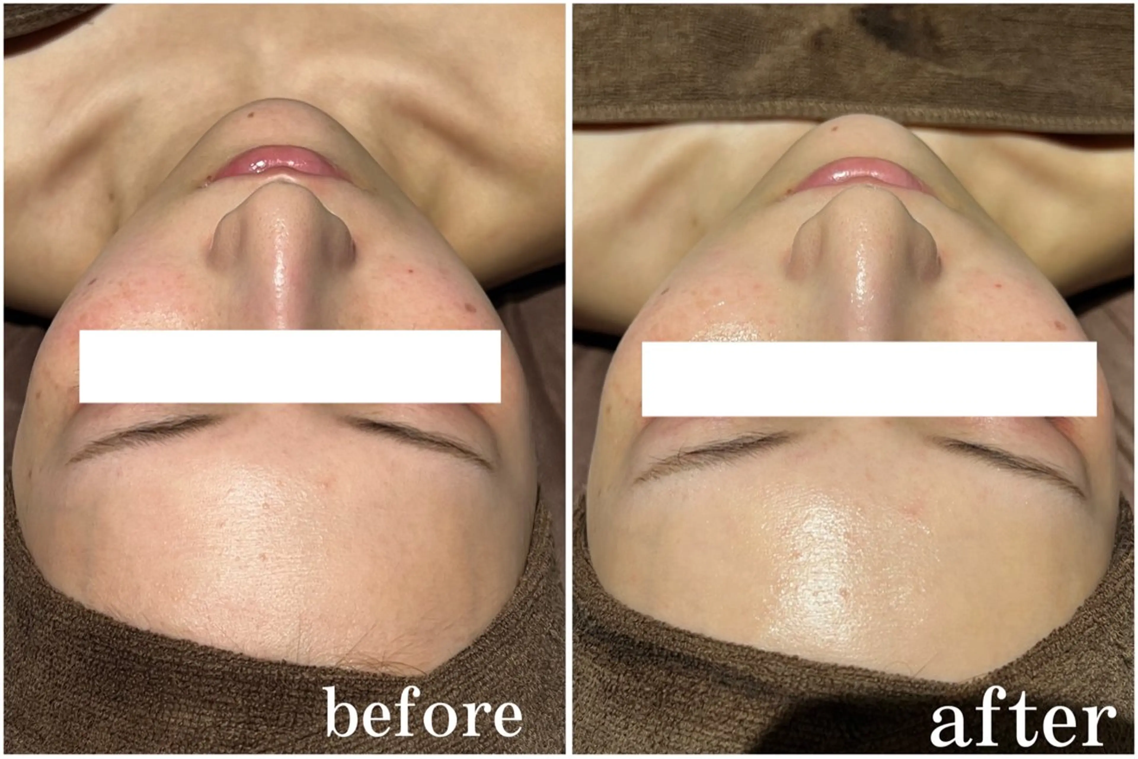 その他 NAZ  (ナーズ)のエステ・リラクイメージ