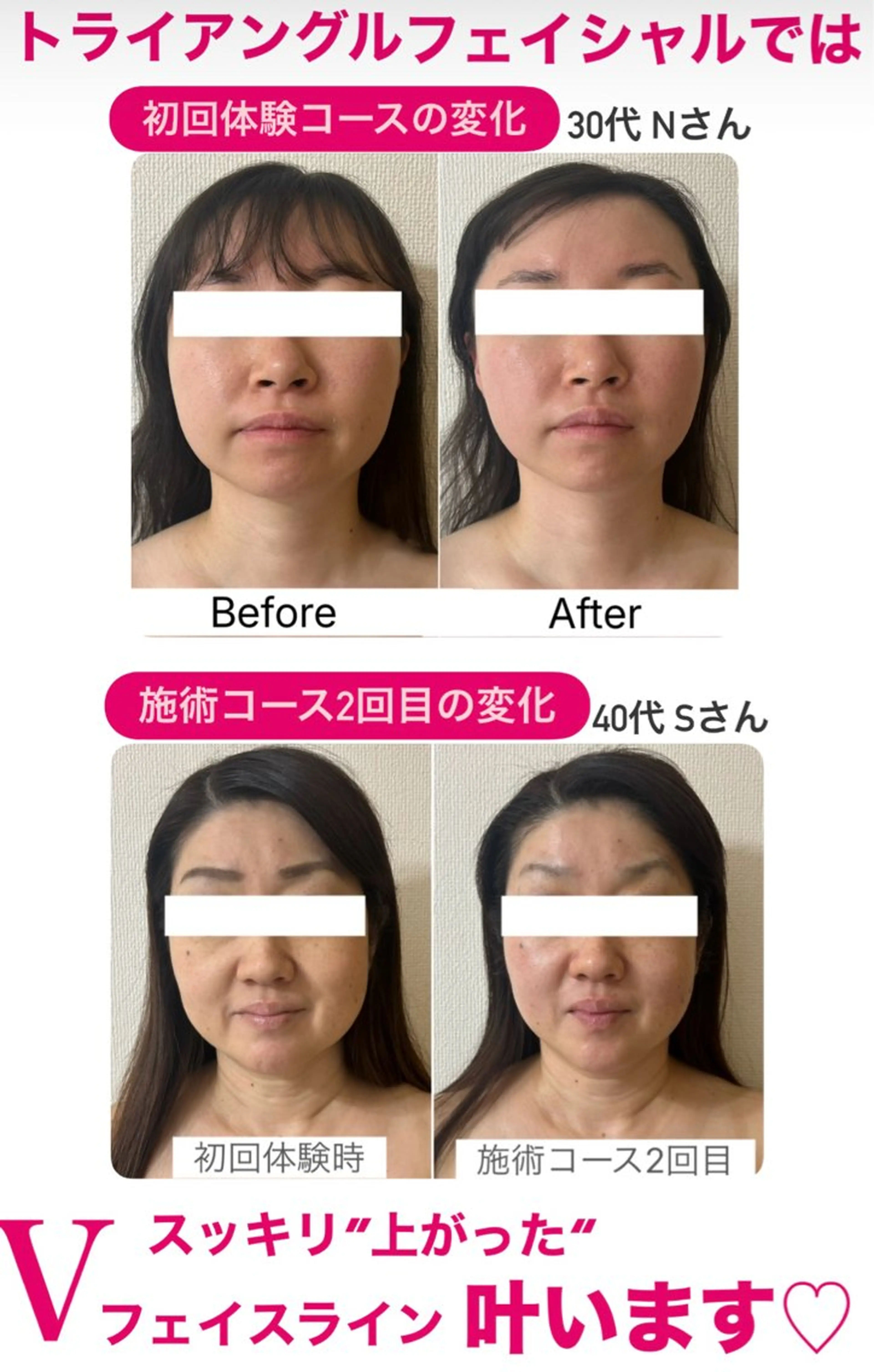 la lumie're (ラ リュミエール)所属・小顔サロン (ラ リュミエール)のエステ・リラクイメージ