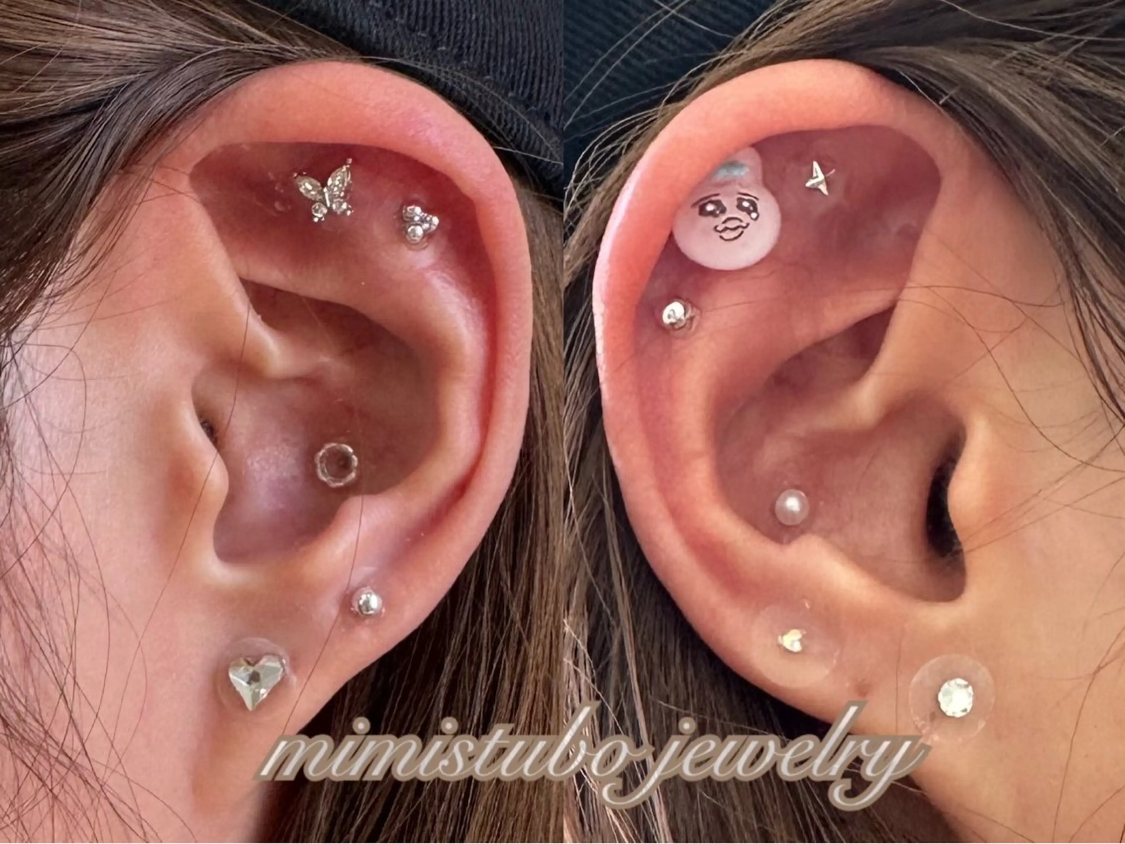 ◯△□所属・最新美肌脱毛 韓国水光肌🫧のその他イメージ