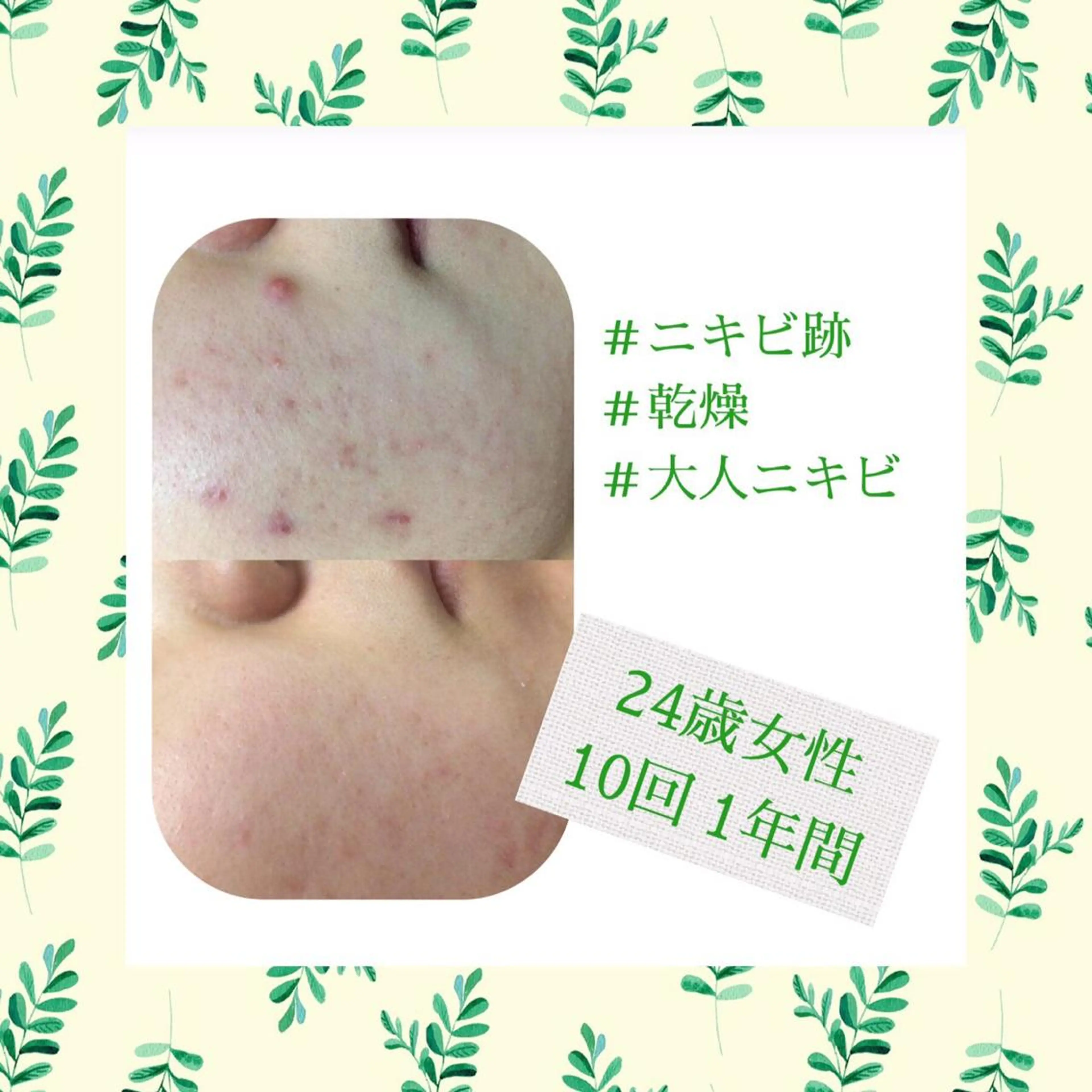 ミディアム カラー パーマ ヘアアレンジ メンズ キッズ ネイル マツエク・マツパ エステ リラク ニキビ・肌質改善専門 ♡人生が変わるサロンのエステ・リラクイメージ