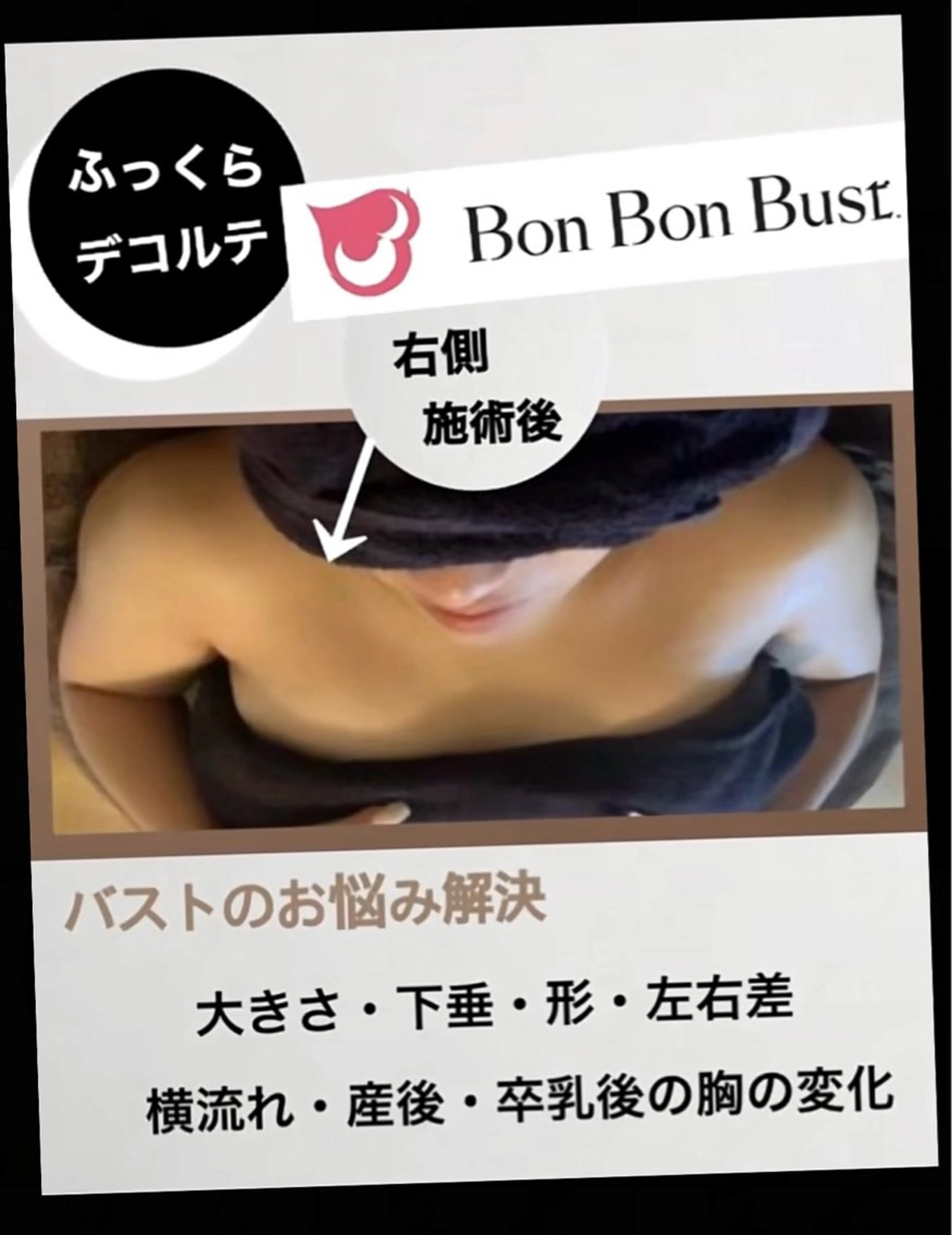 エステ ヴィーナス ビューティーのエステ・リラクイメージ