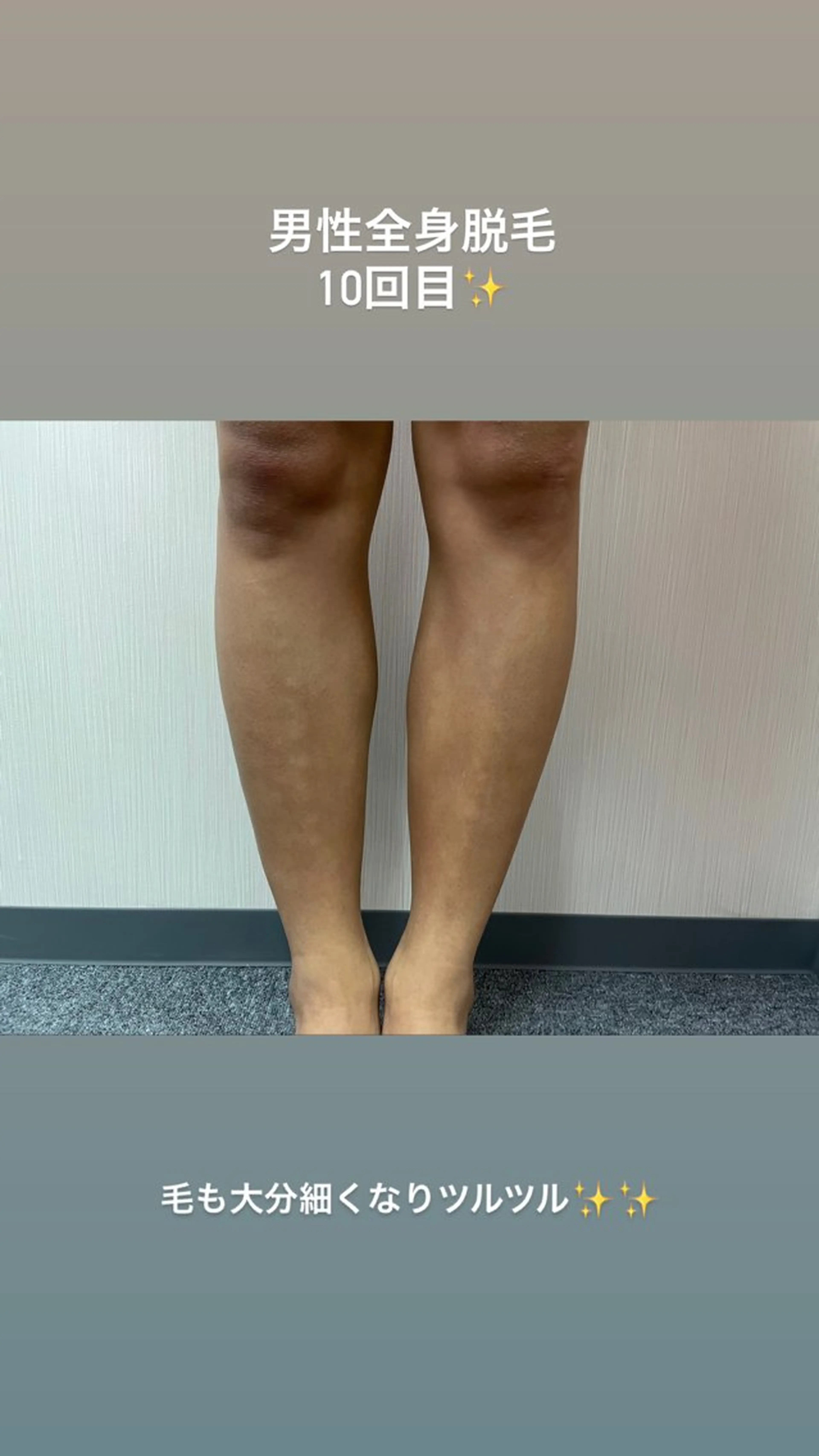 メンズ 脱毛 SÉALIE所属・SÉALIE 脱毛サロンのエステ・リラクイメージ