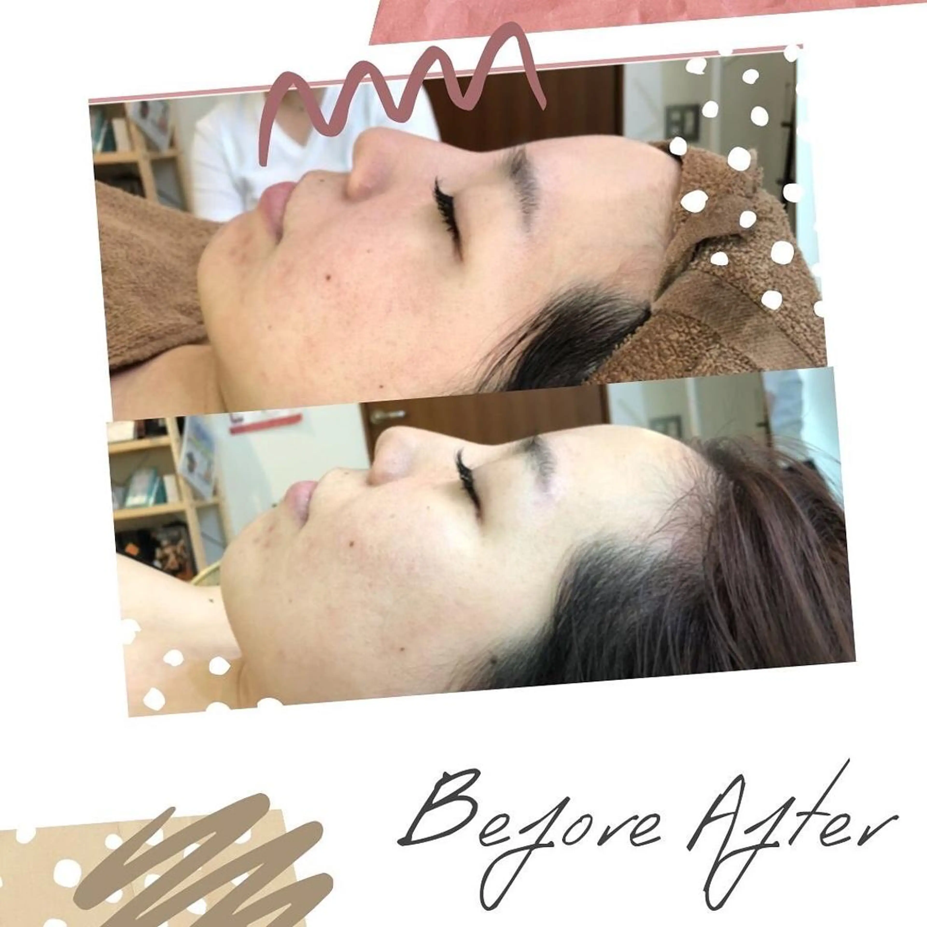 エステ 温活beautyサロンNeroli所属・切らない脂肪吸引🔥 Neroliまりこのエステ・リラクイメージ