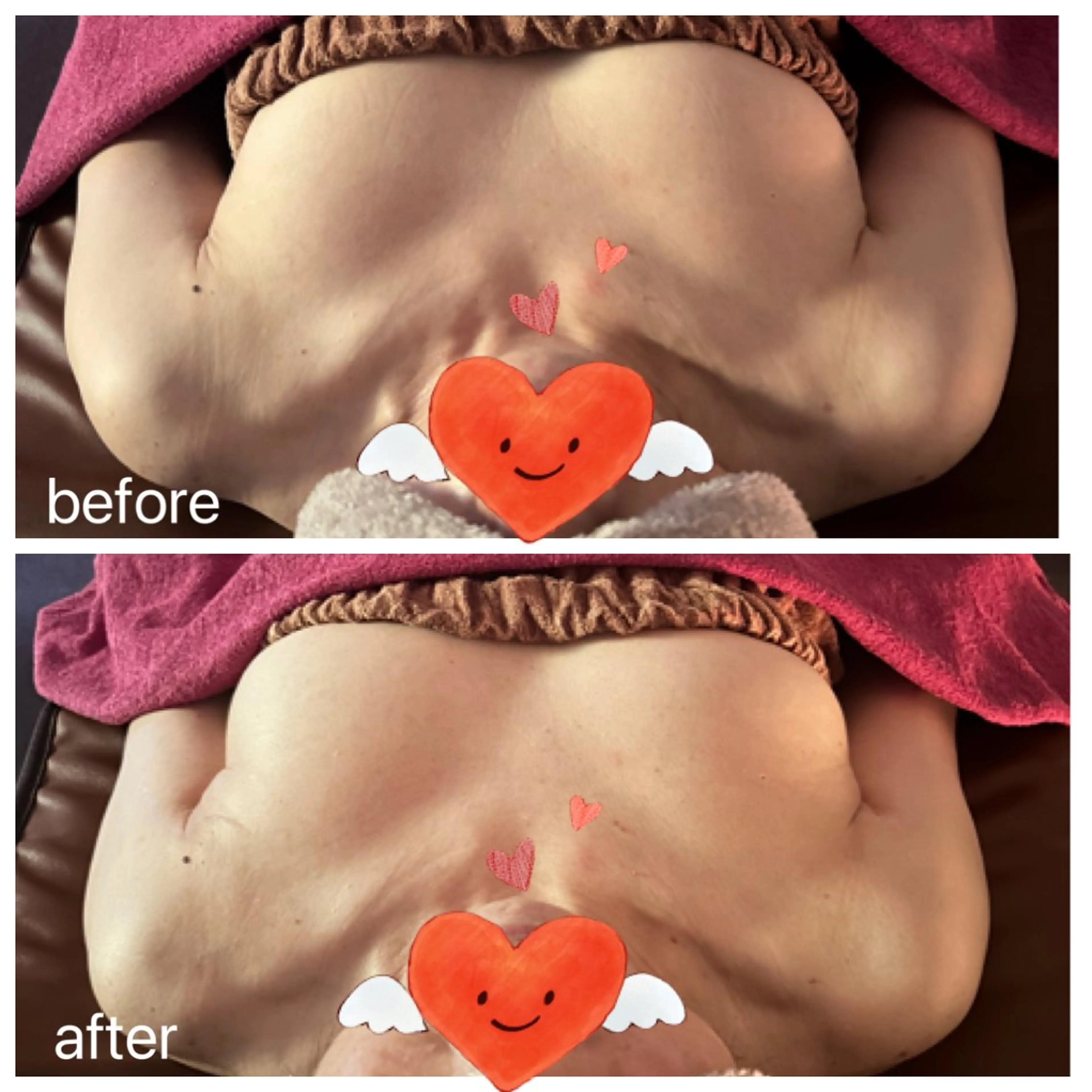 バストアップ専門 おっぱい先生いそのその他イメージ