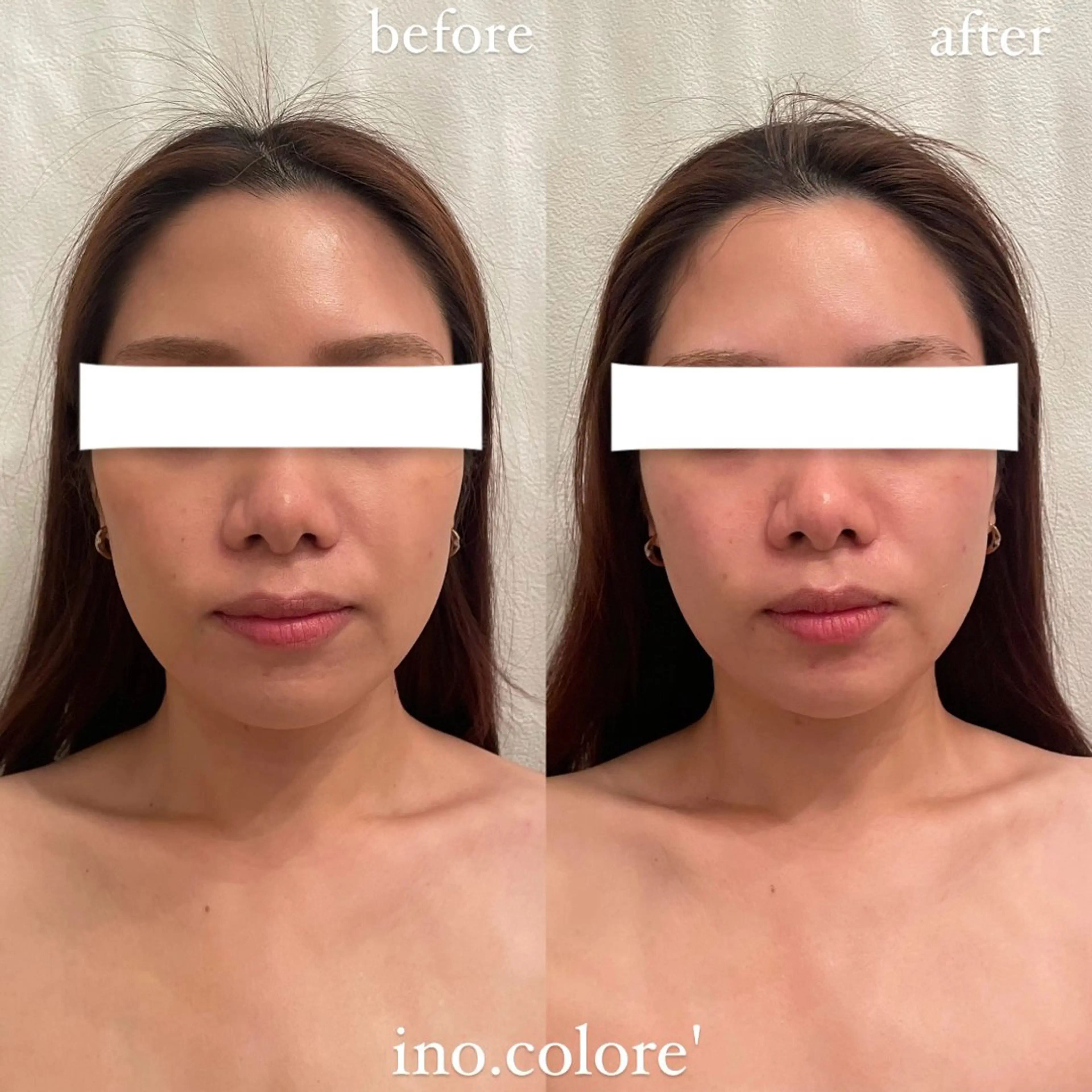 エステ リラク エステサロンino.colore'所属・小顔サロン ino.coloreのエステ・リラクイメージ