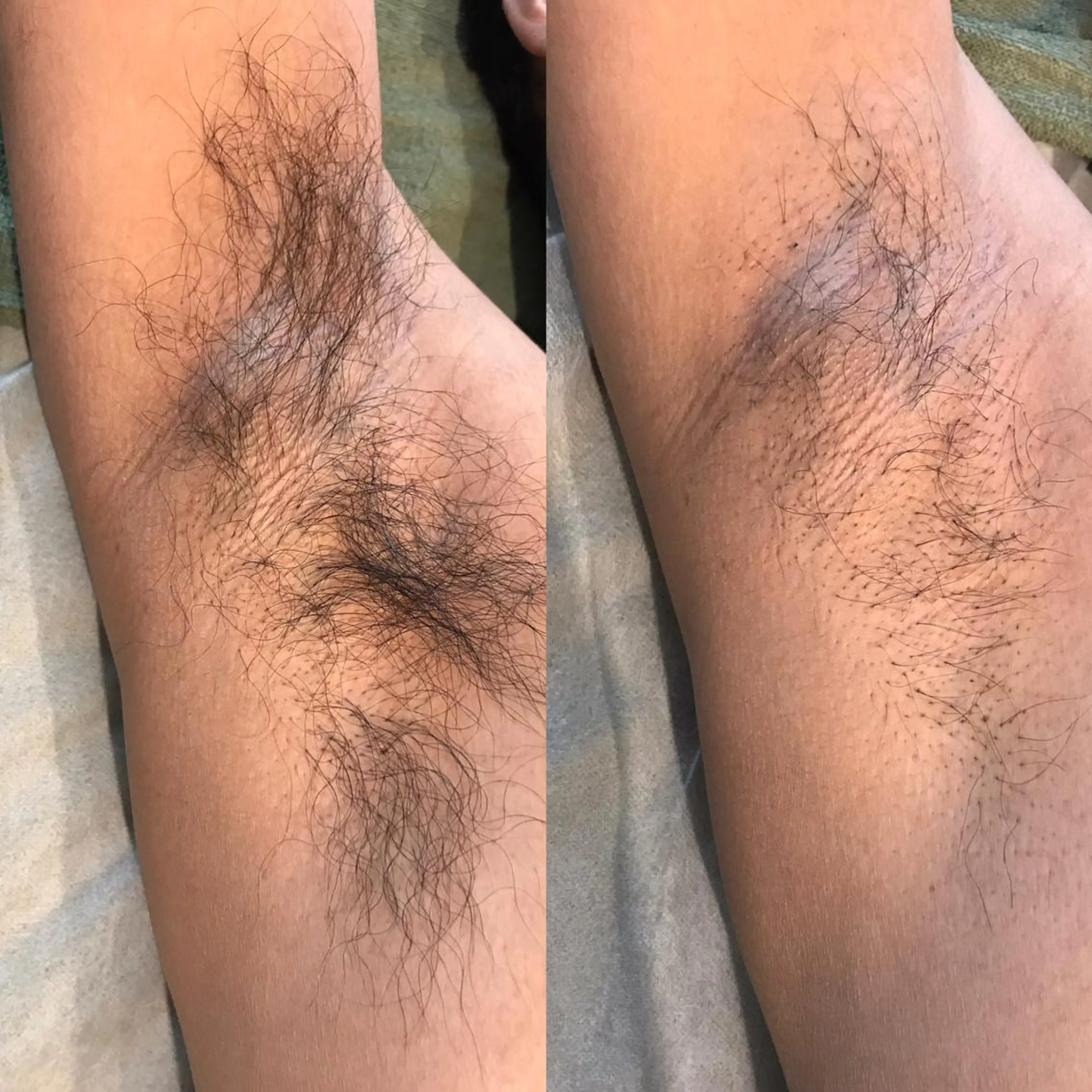 ビューティーサロン リノアのエステ・リラクイメージ