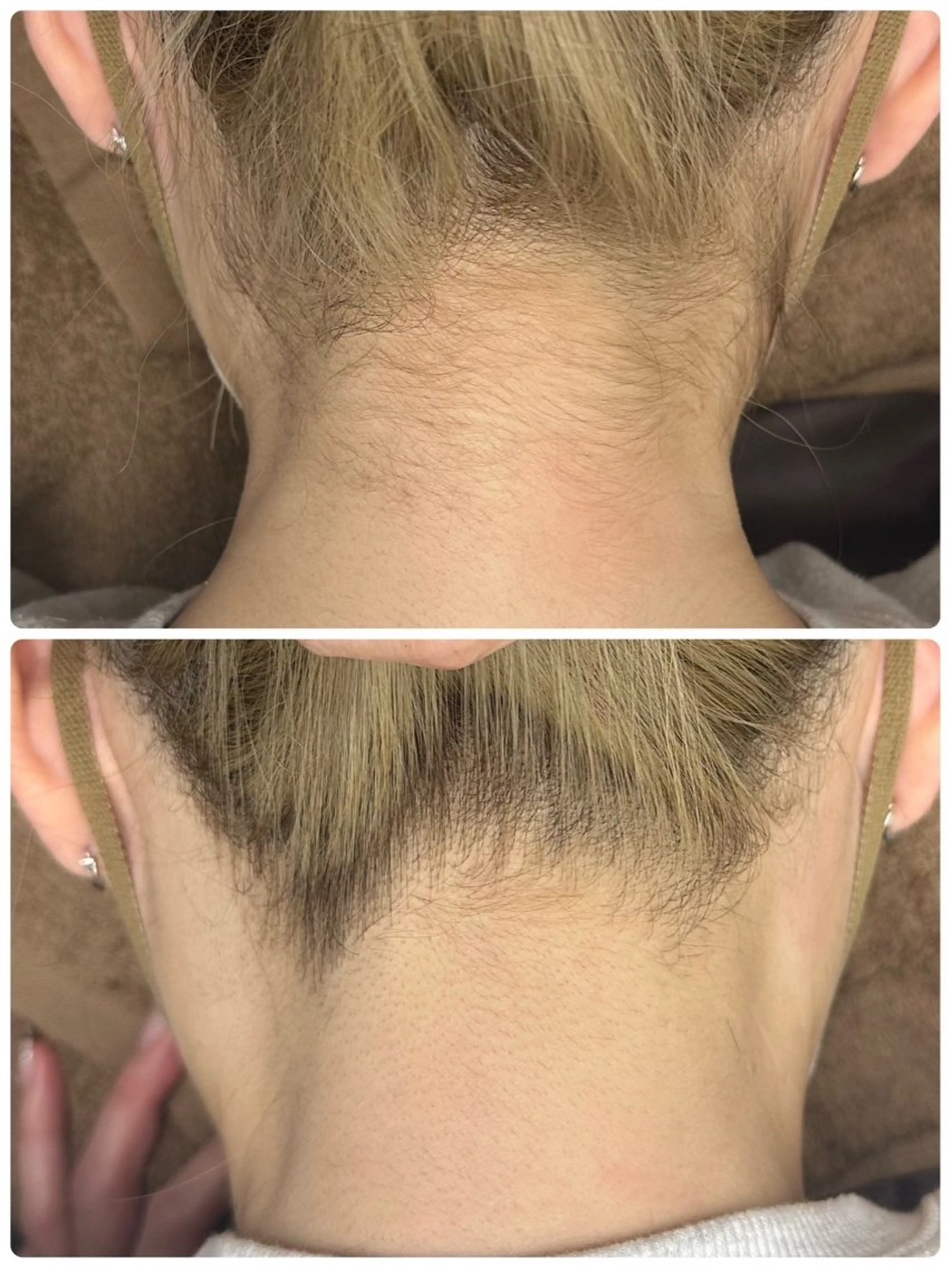 ◯△□所属・最新美肌脱毛 韓国水光肌🫧のその他イメージ