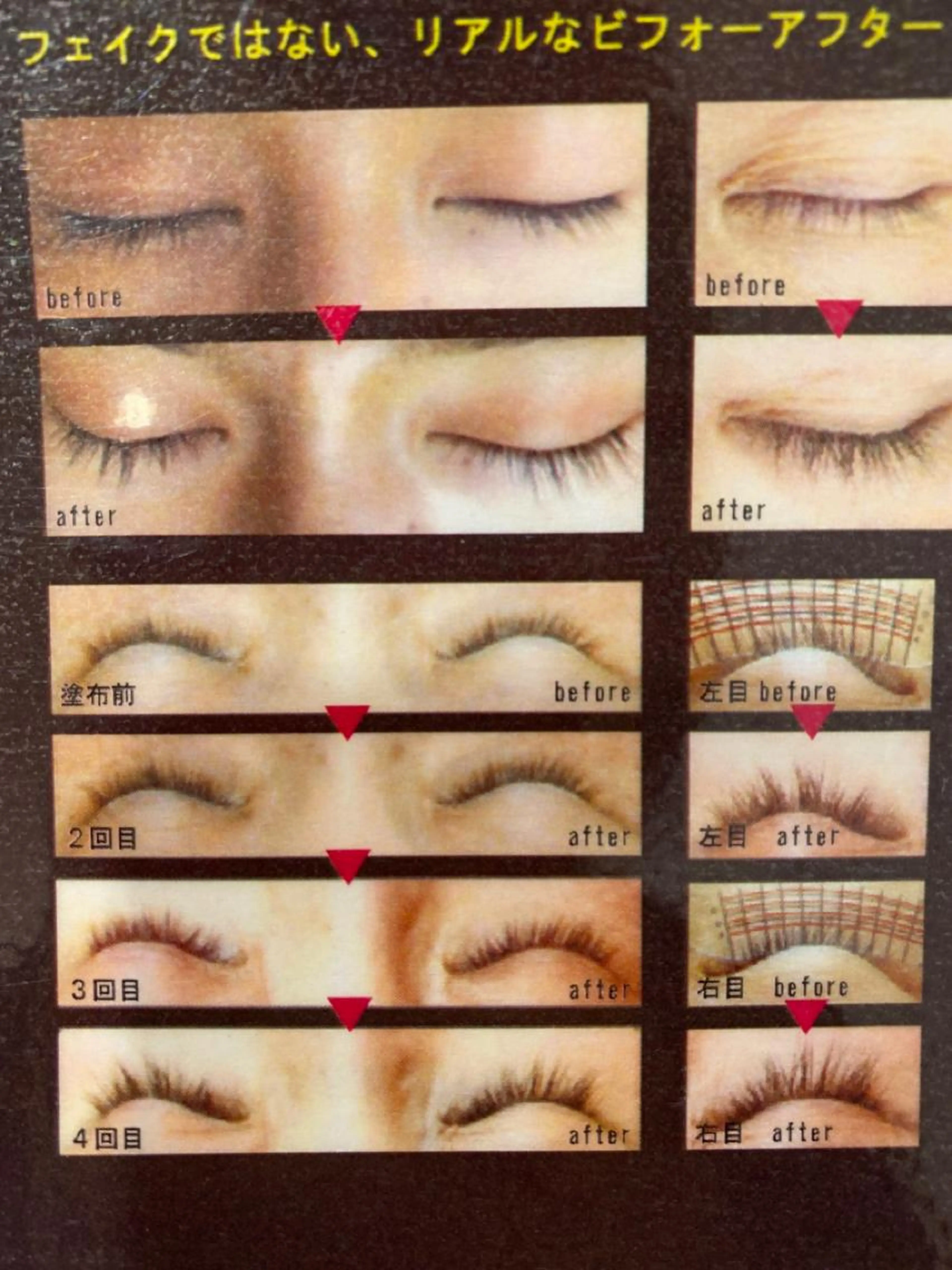 👀🌟ラッシュアディクト・まつ毛育成🌟👀の写真