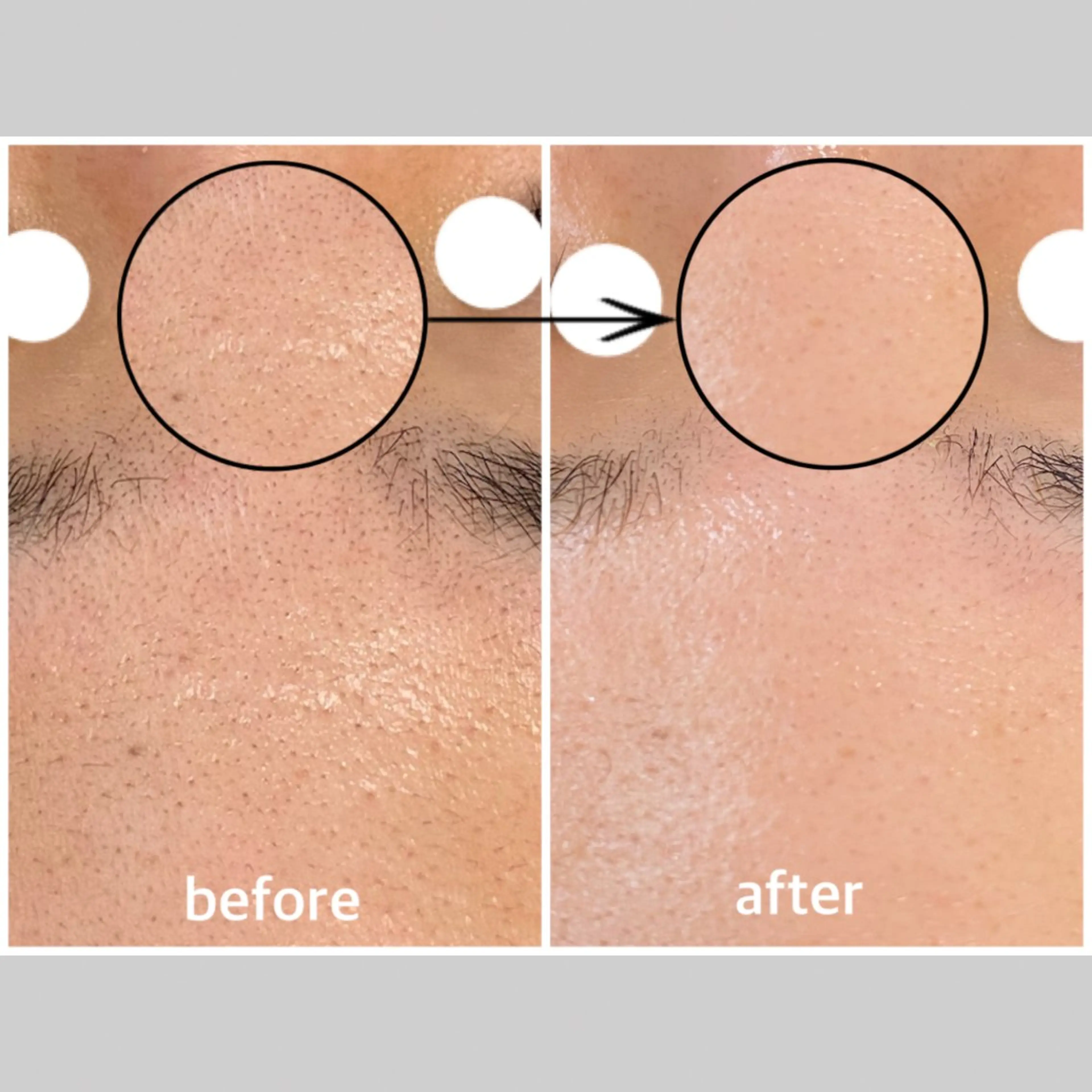 エステ リラク 韓国肌管理 【毛穴専科】のエステ・リラクイメージ