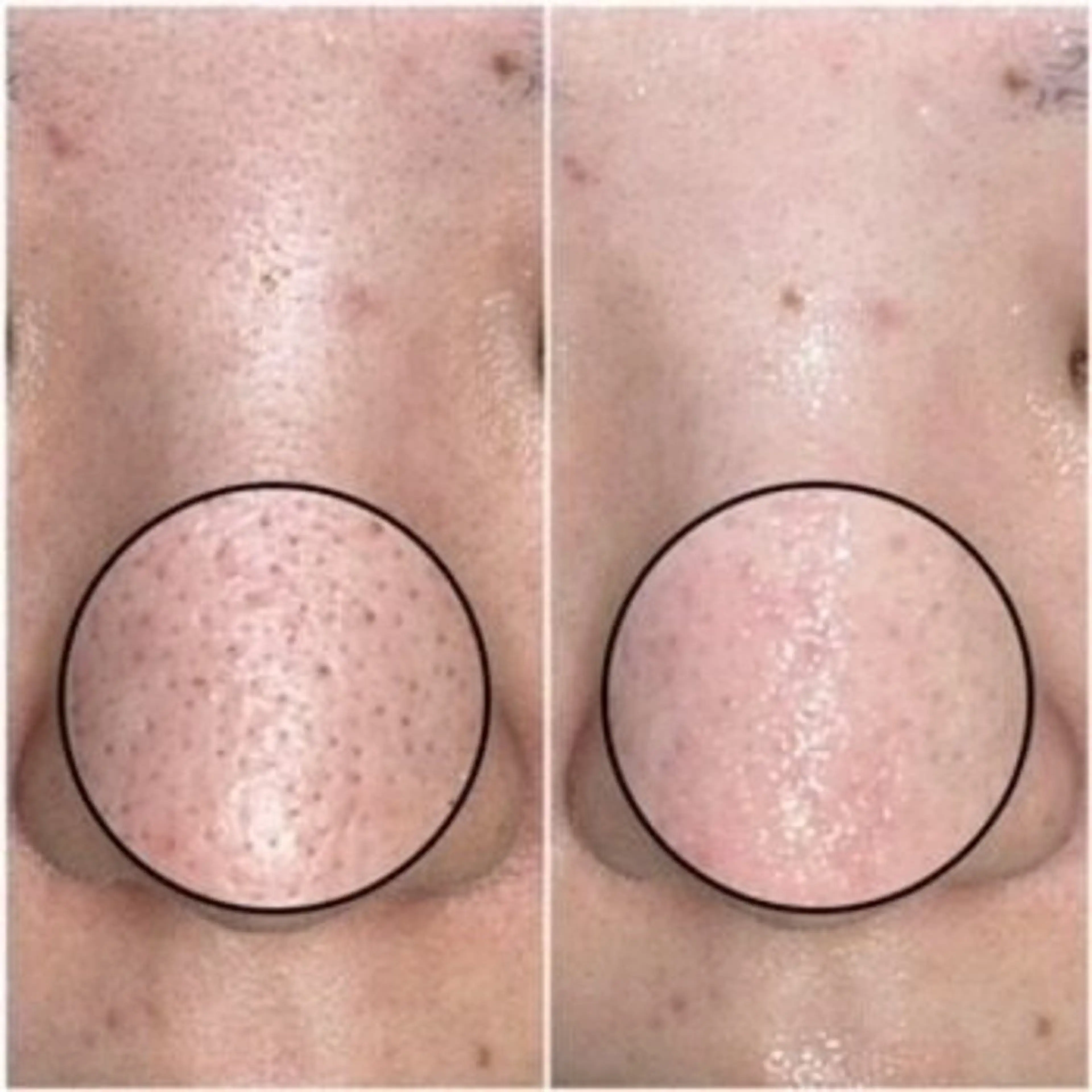 エステ 上西 こころのエステ・リラクイメージ