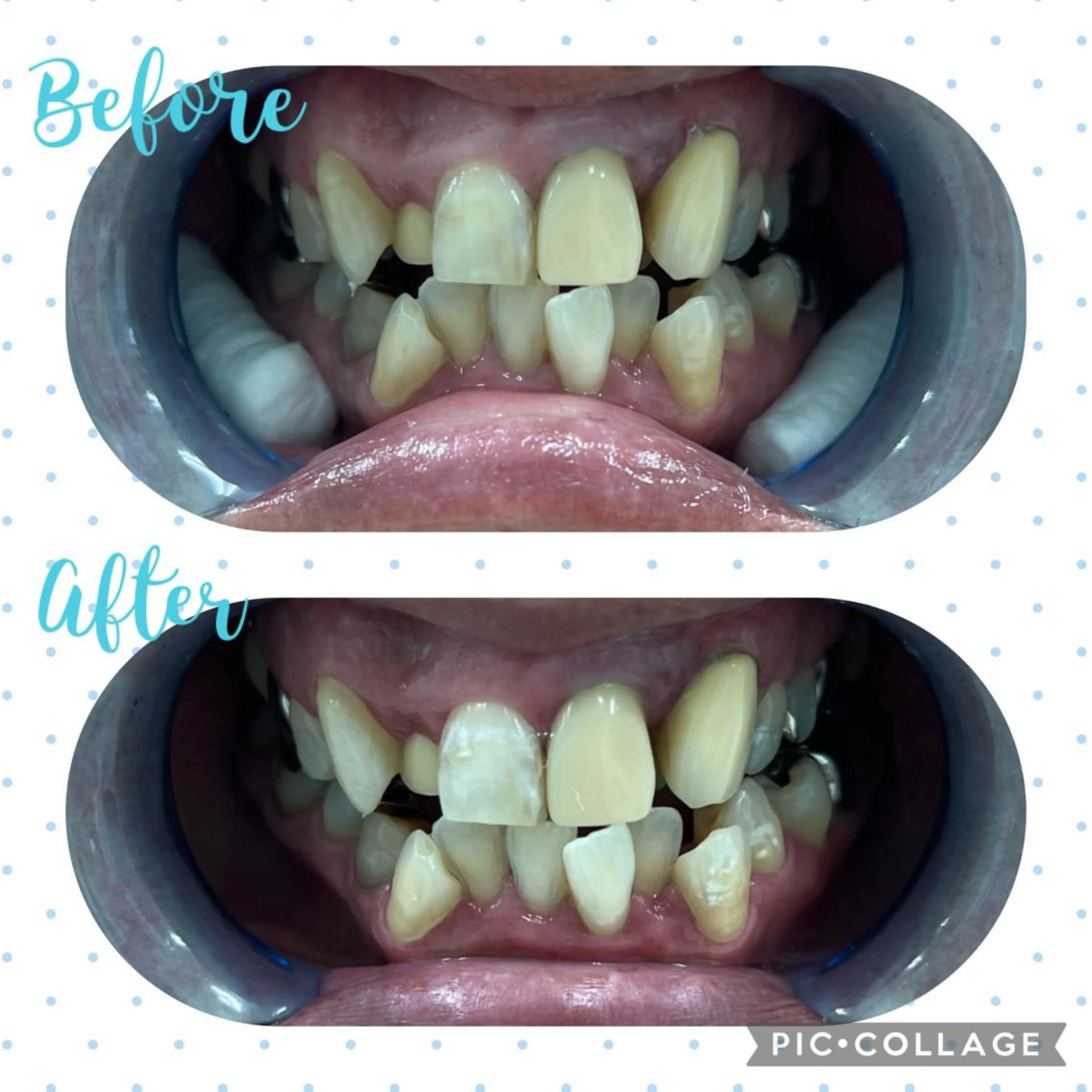 その他 セルフホワイトニングCOCOSHIRO所属・セルフホワイトニング COCOSHIROのエステ・リラクイメージ