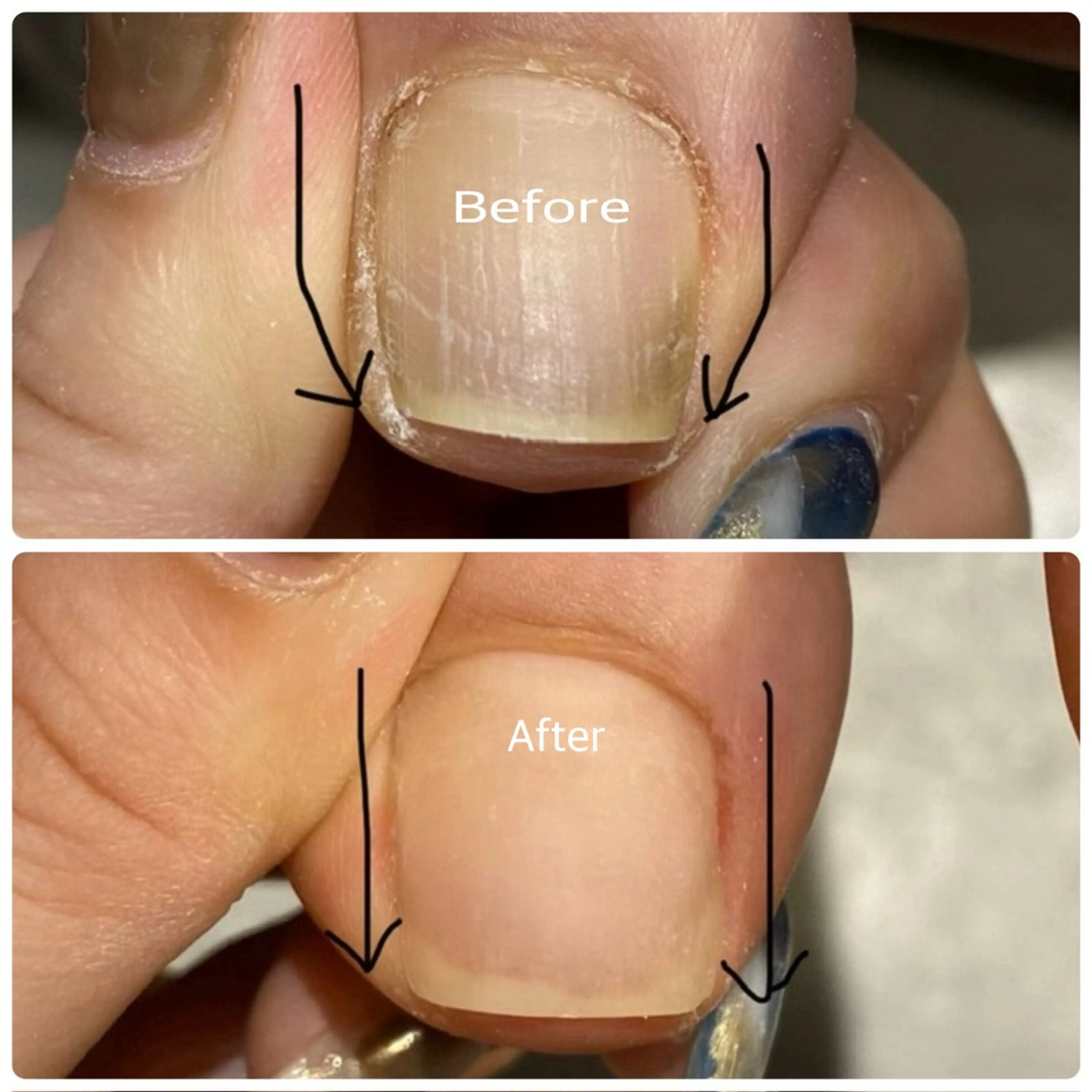 ネイル diar　blue湘南台店所属・💅 ERIのネイルデザイン