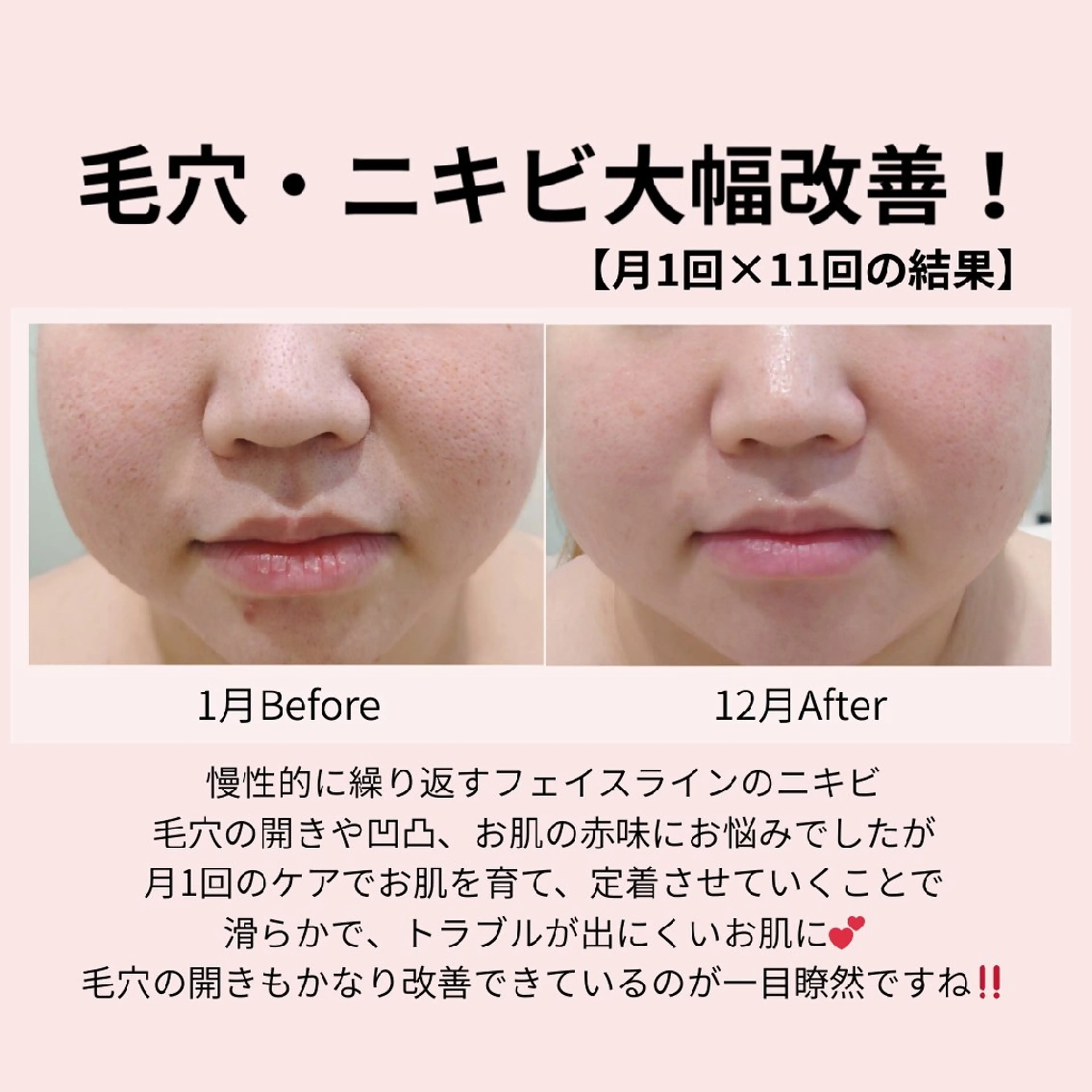 エステ PRETTIEST SHINE所属・フェイシャル/ボディ /ブライダル山田浩子のエステ・リラクイメージ