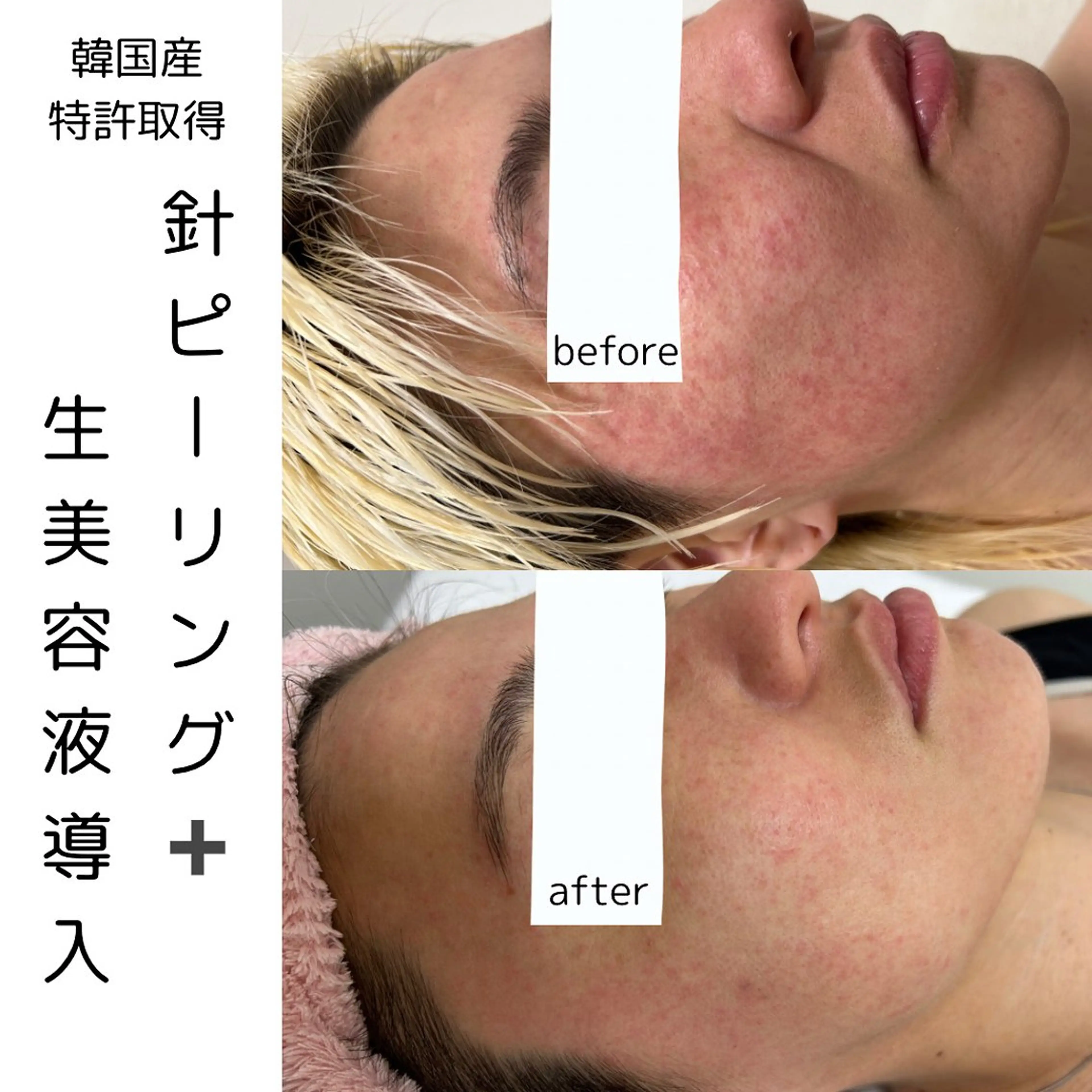 エステ リラク 歌舞伎町深夜サロン to mëのエステ・リラクイメージ